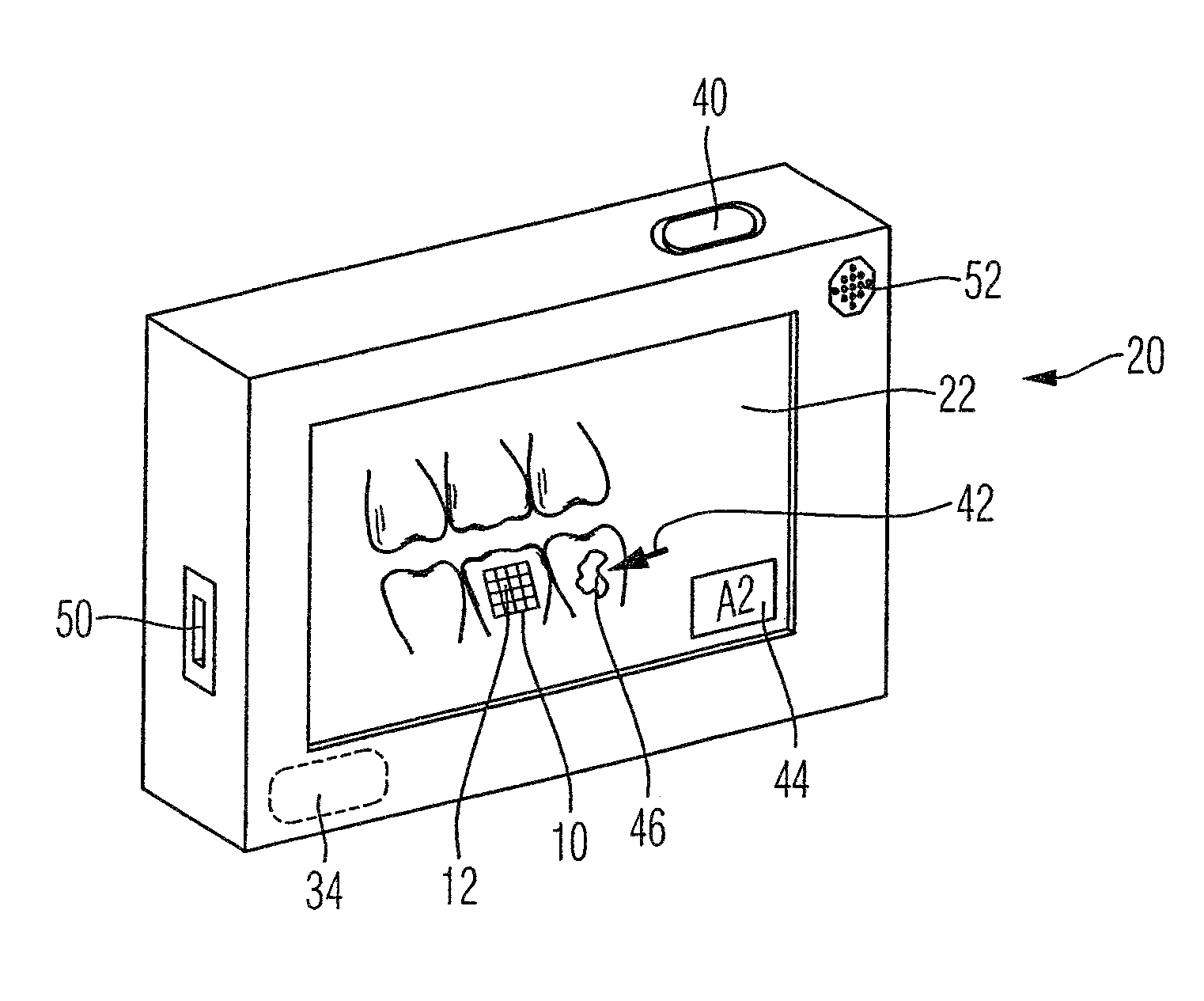 Dental color analyzing device and methof of use