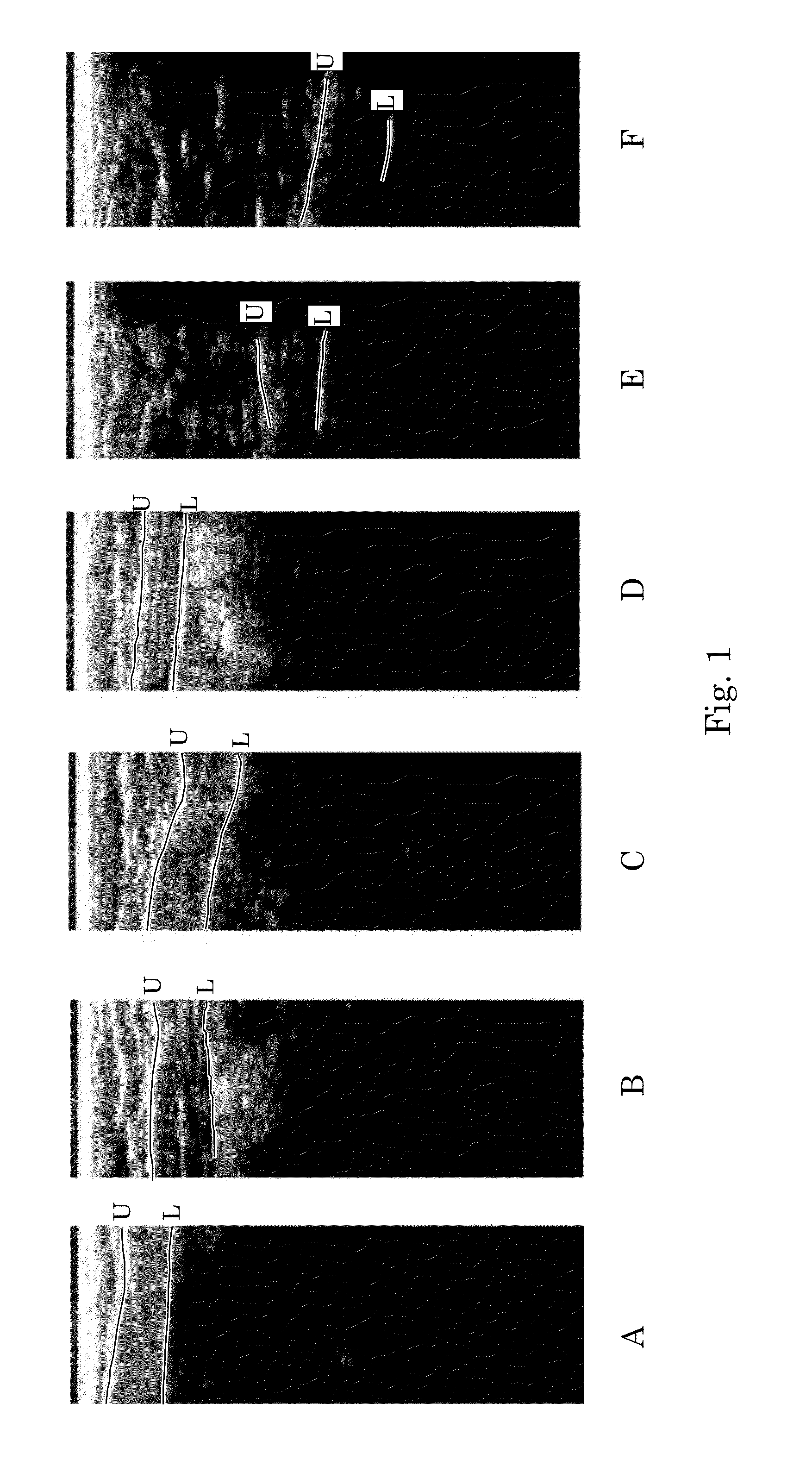 Ultrasound image object boundary localization by intensity histogram classification using relationships among boundaries