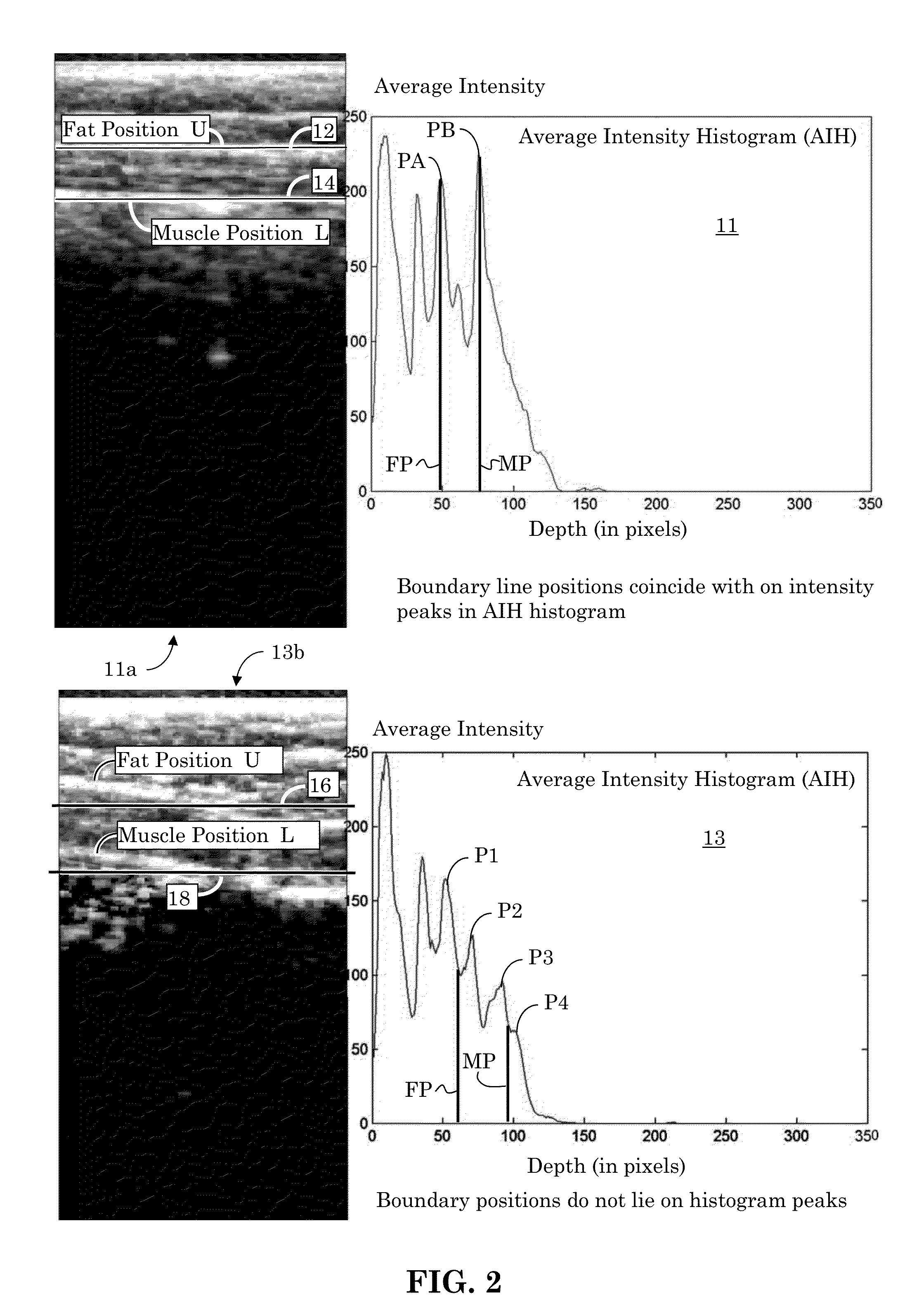 Ultrasound image object boundary localization by intensity histogram classification using relationships among boundaries