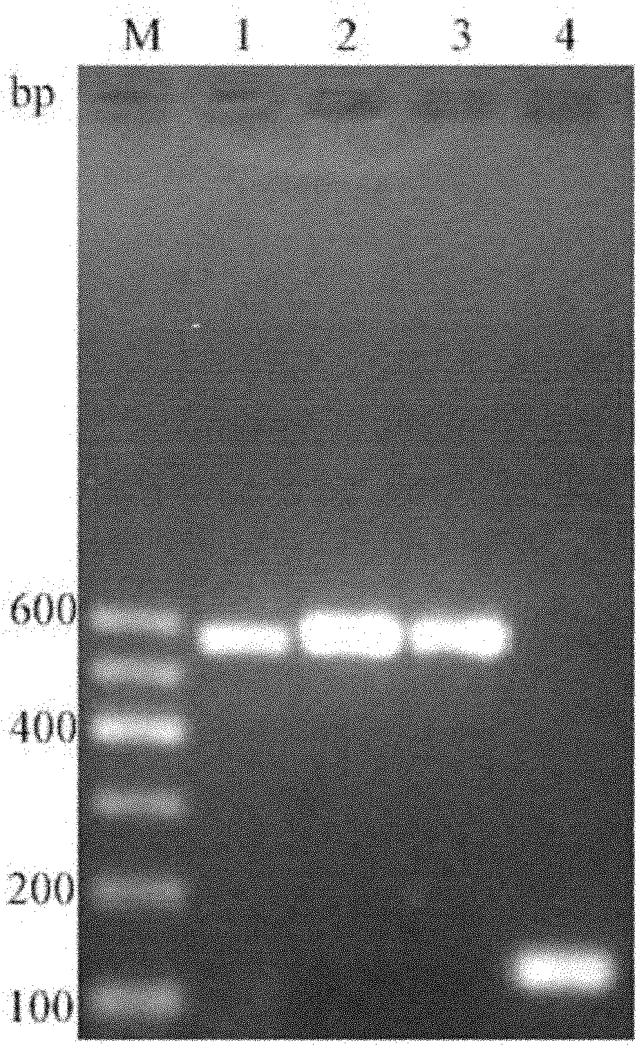 Staphylococcus aureus enterotoxin gene PCR (Polymerase Chain Reaction) parting detection kit and method