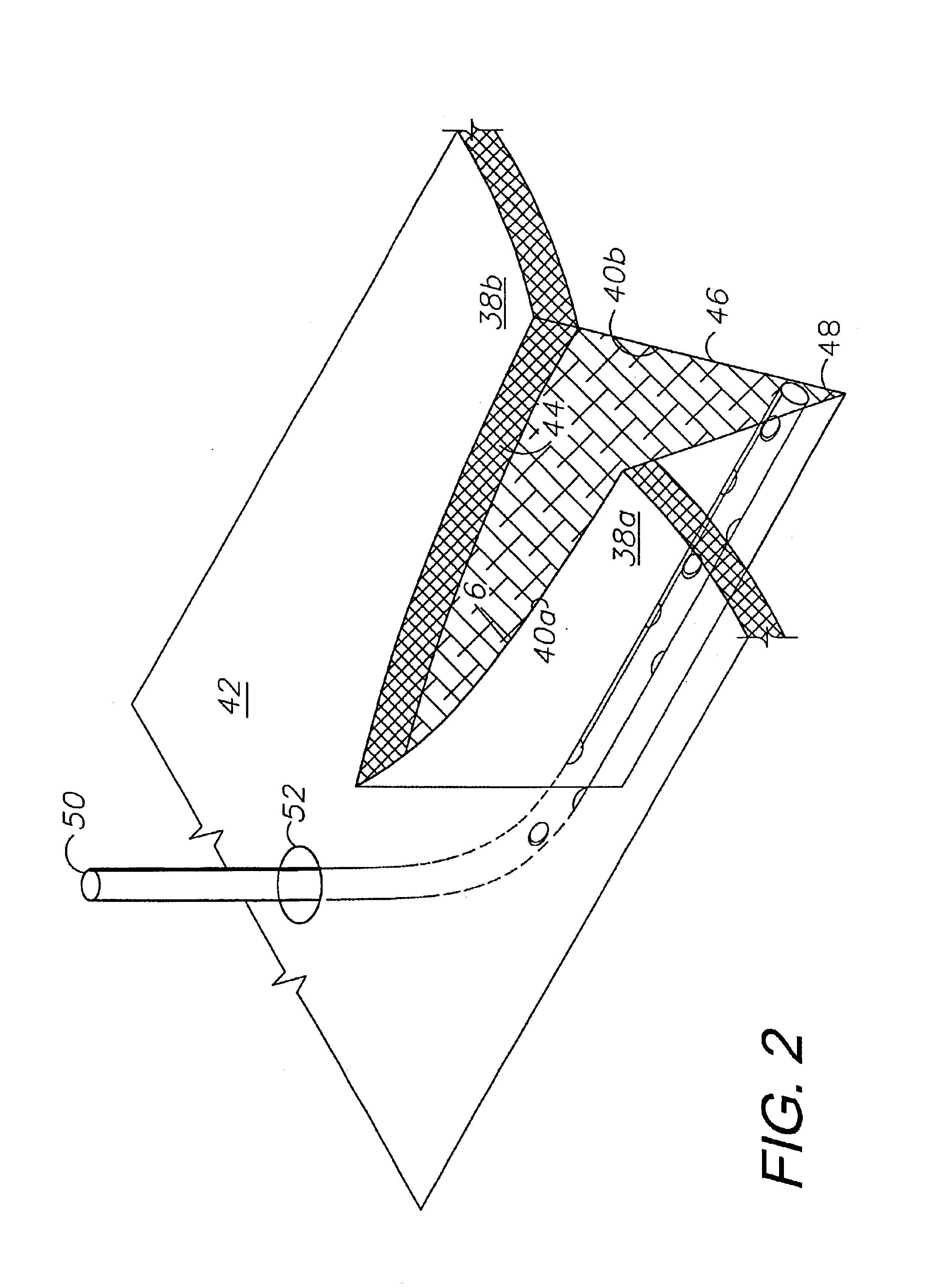 Tissue closure treatment system and method with externally-applied patient interface