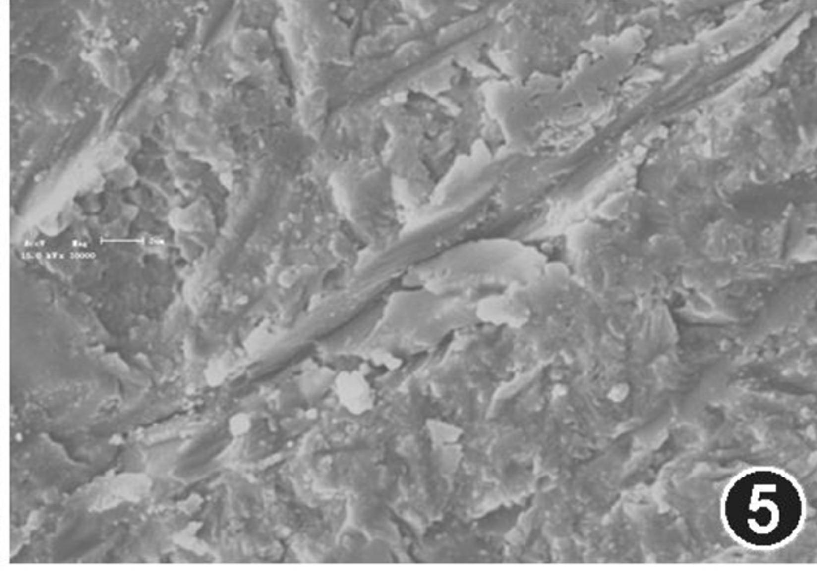 Surface treatment method for zirconium oxide body, zirconium oxide veneering porcelain composite material and preparing method thereof