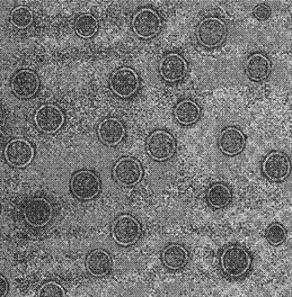 Apramycin liposome and preparation method thereof