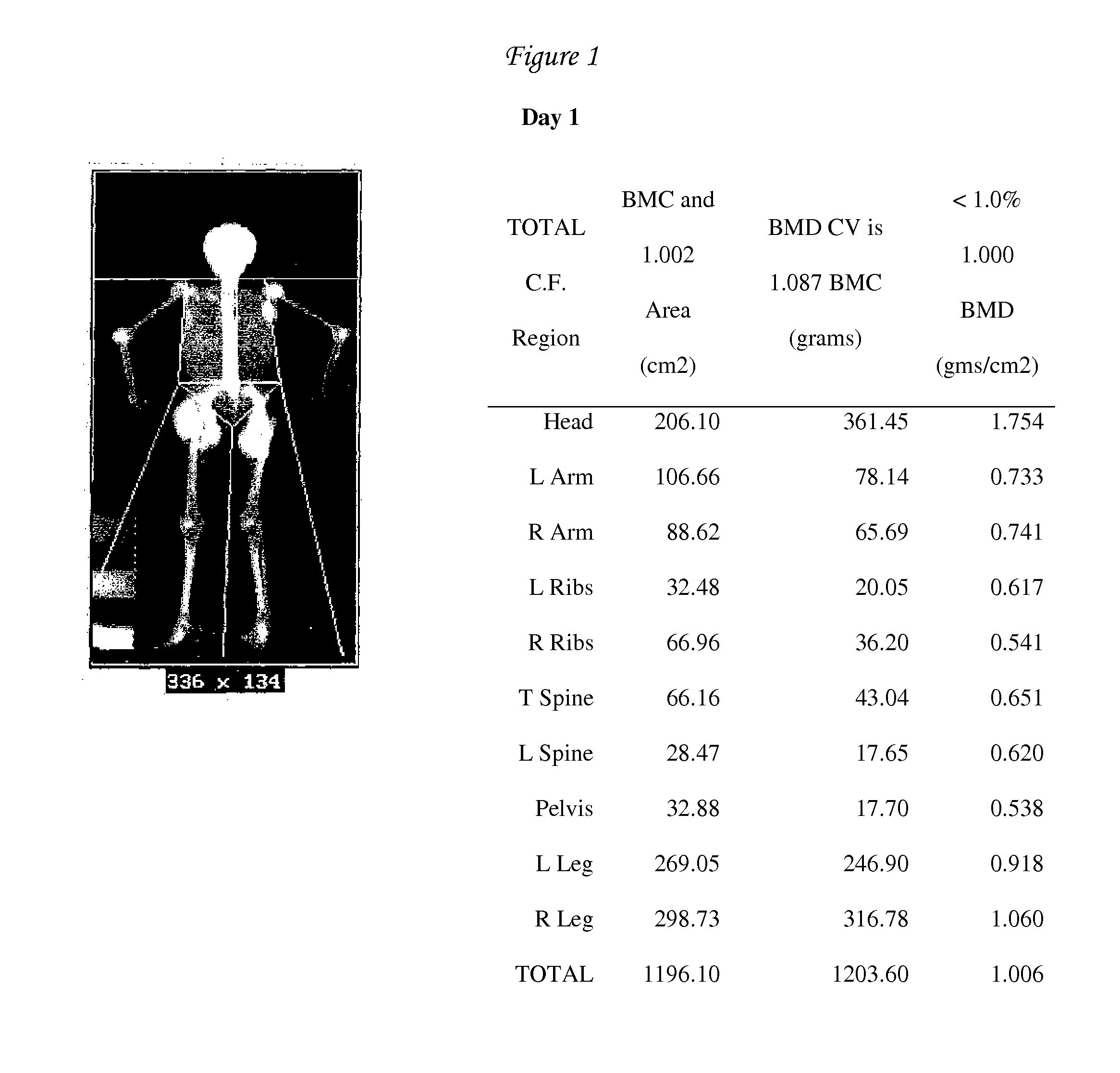 Peritoneal Dialysis Method