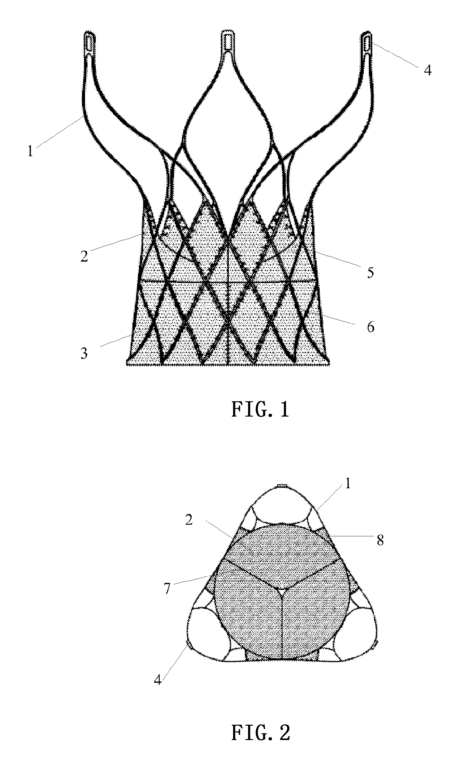 Invasive cardiac valve