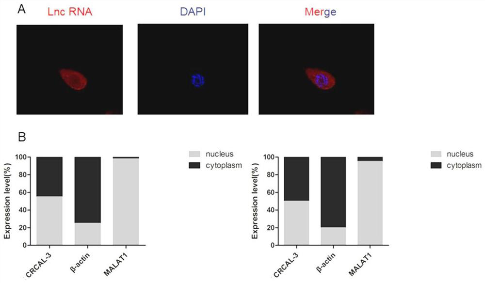 Application of long-chain non-coding RNA CRCAL-3 inhibitor in preparation of product for treating radiotherapy-resistant breast cancer