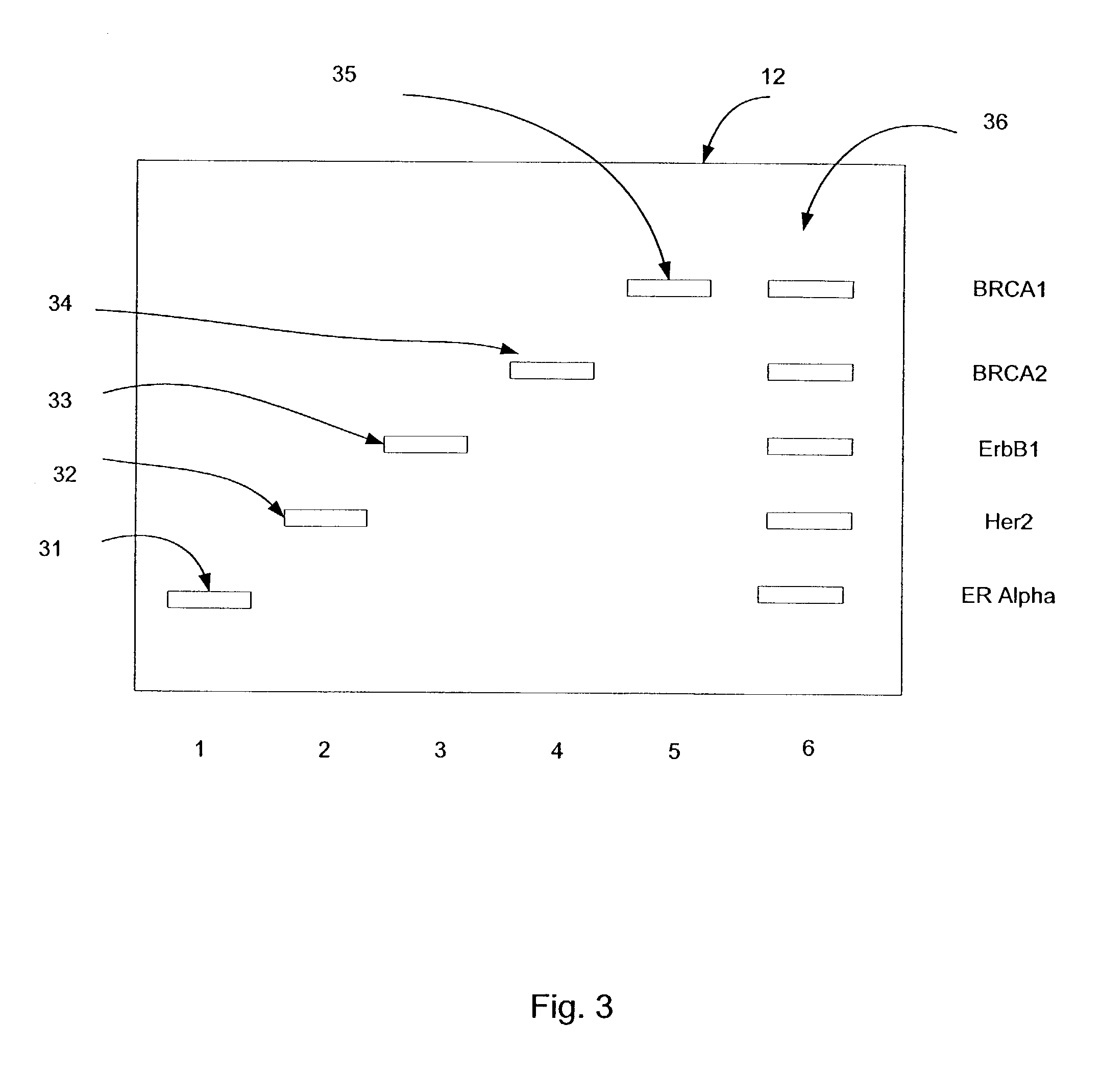 Molecular diagnostic and computerized decision support system for selecting the optimum treatment for human cancer