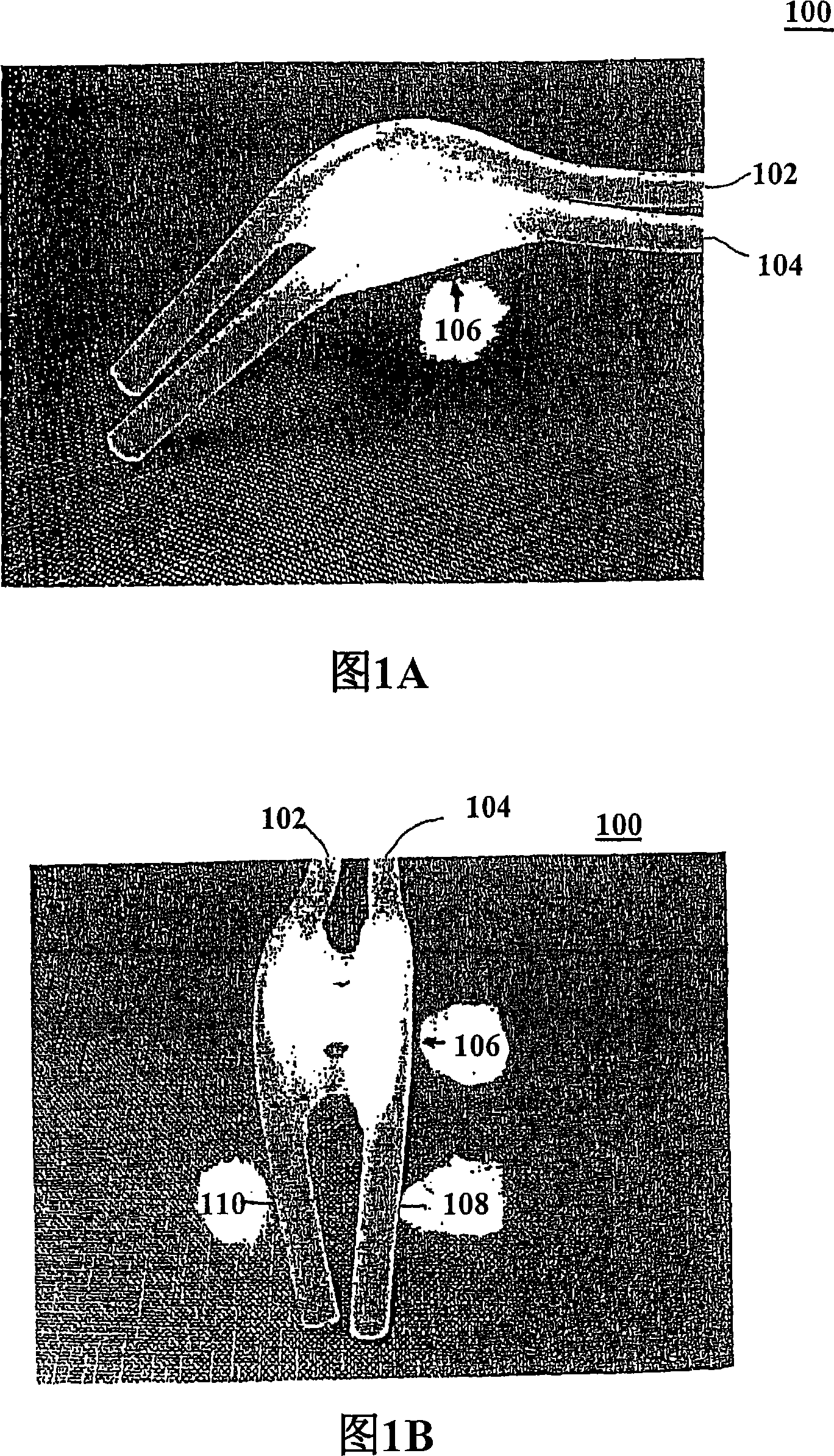 Device and method for photodynamic therapy of the nasopharyngeal cavity