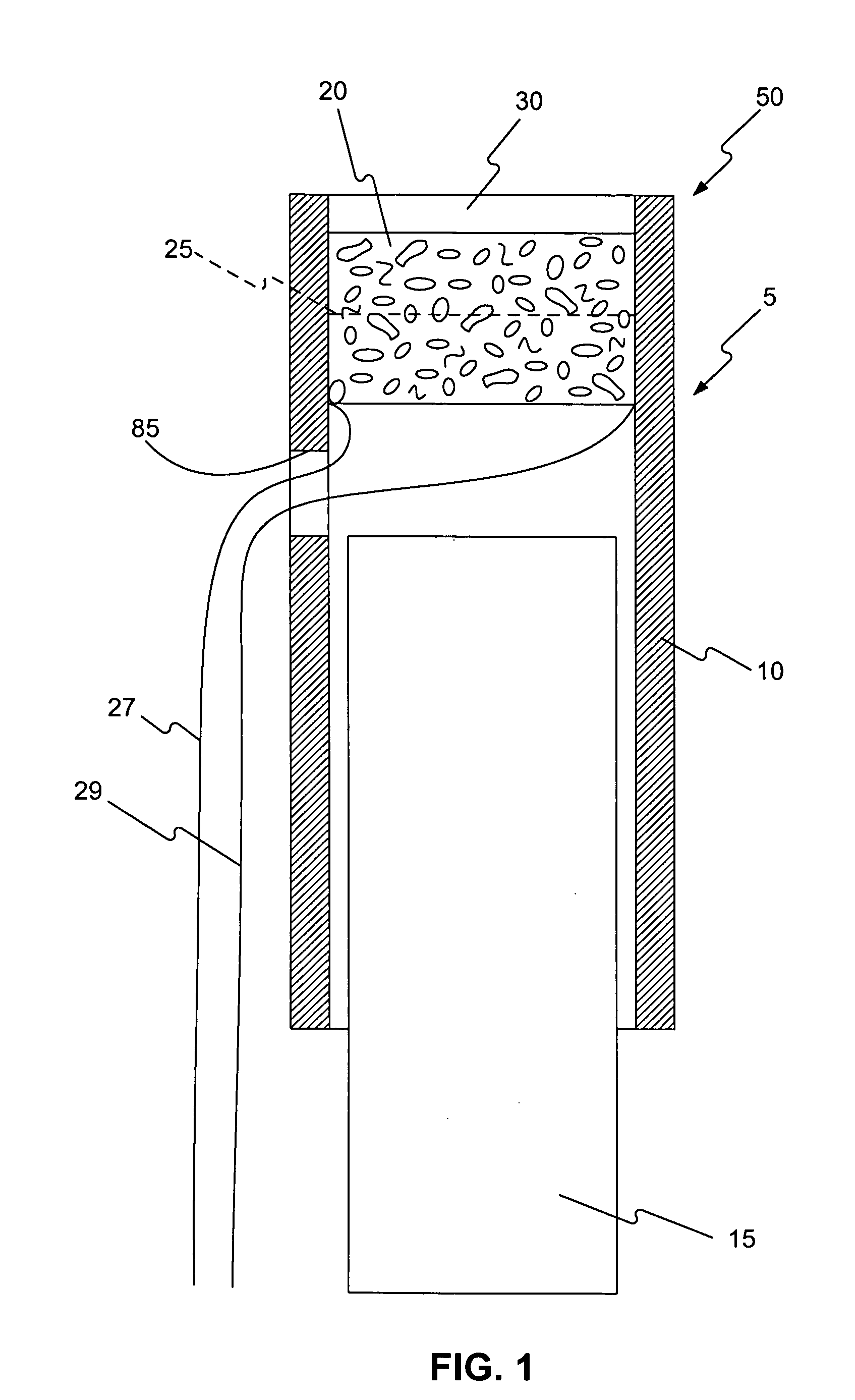 Device to aid in stone removal and laser lithotripsy