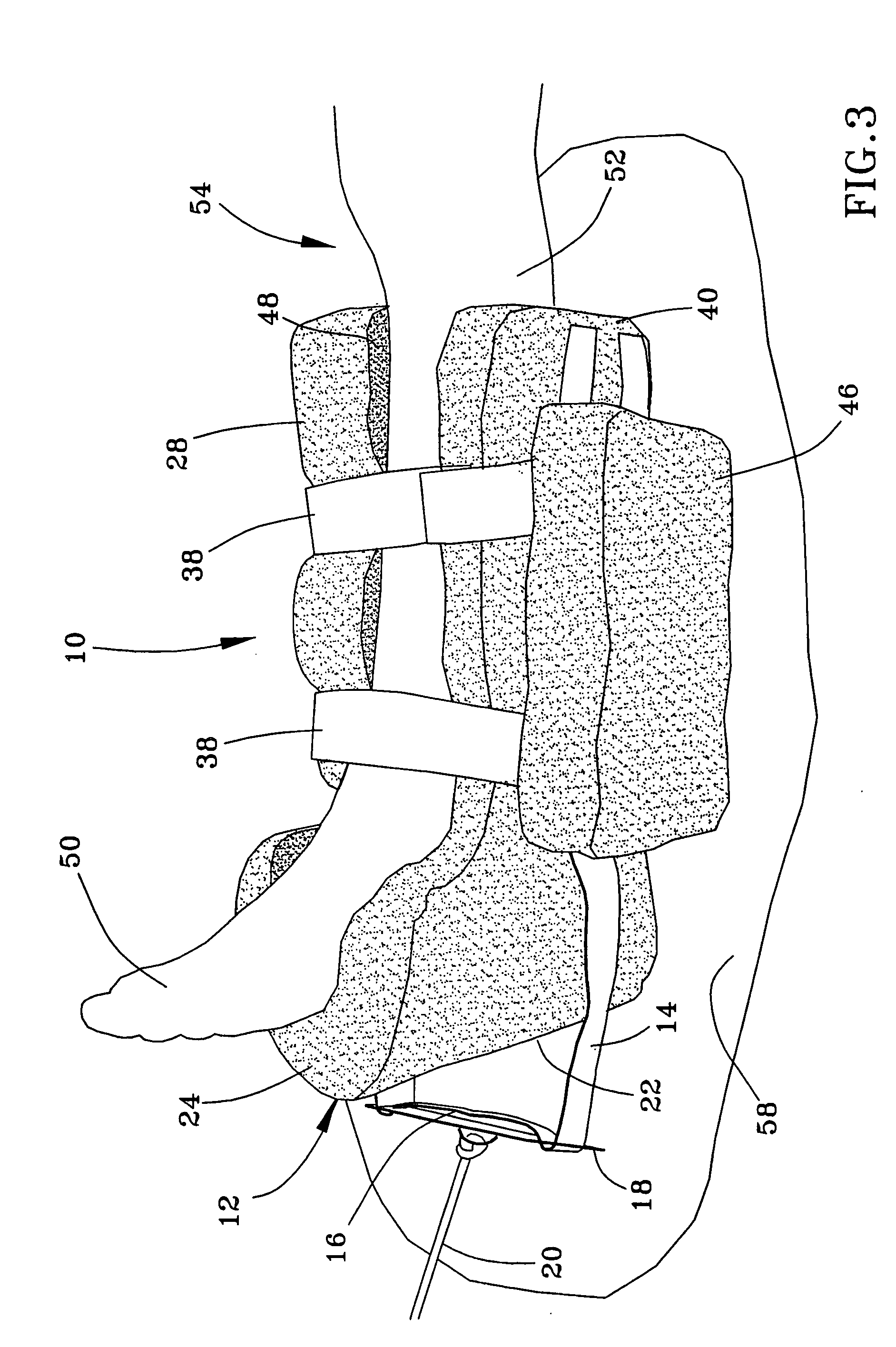 Traction device