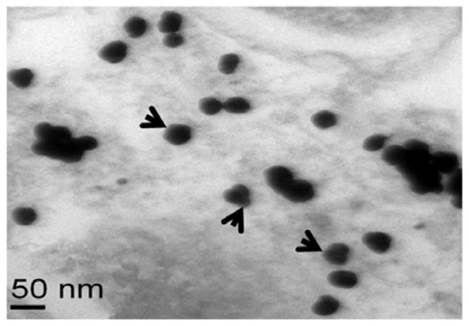 A kind of preparation method of nano gold, nano gold and application