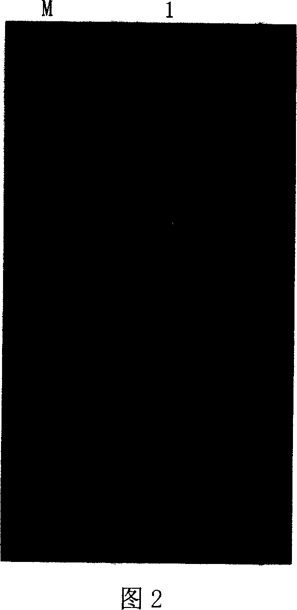 Hydrolyzed soy bean isoflavone glycosidase engineering strain, its construction method and its use