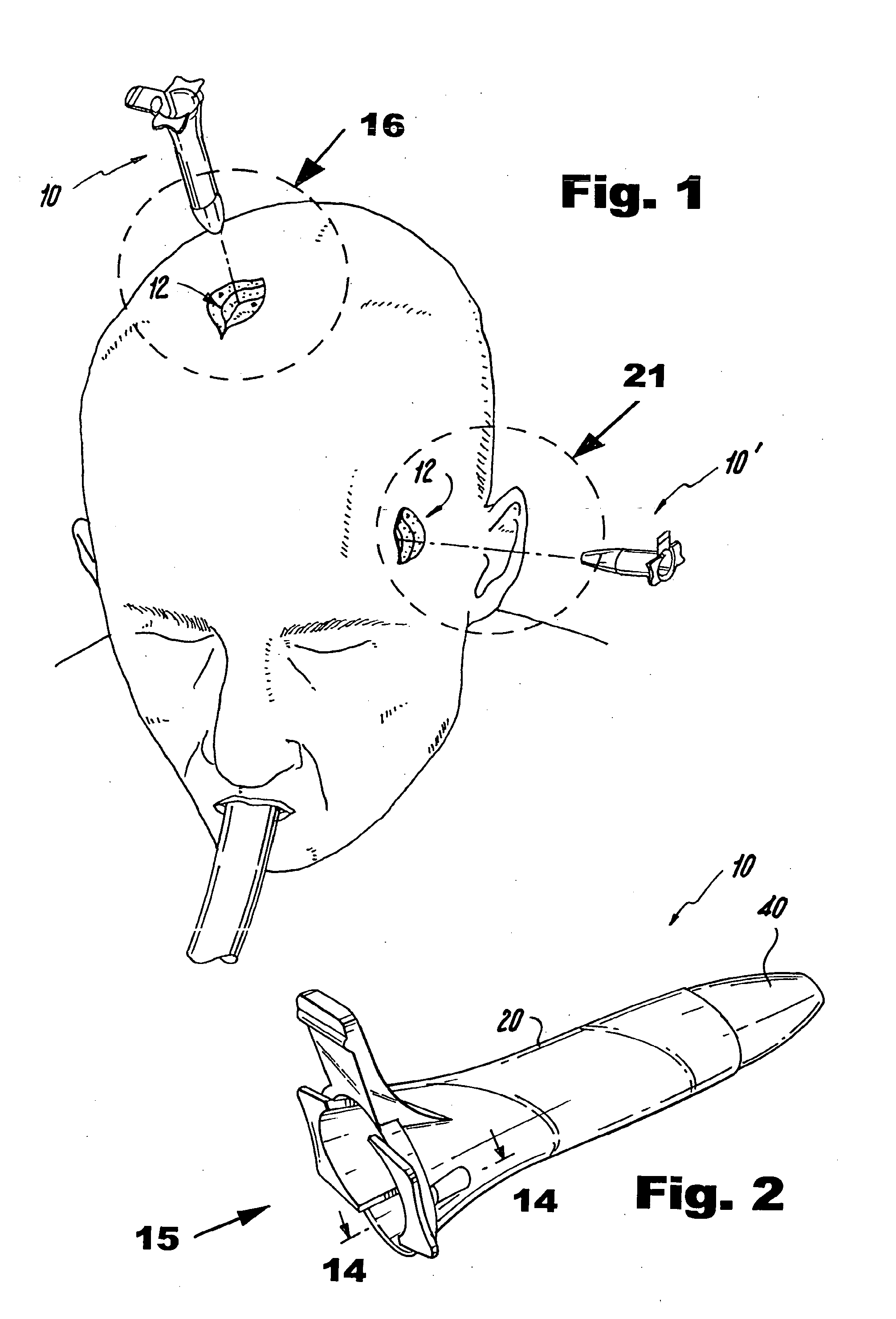 Surgical Access Methods For Use With Delicate Tissues