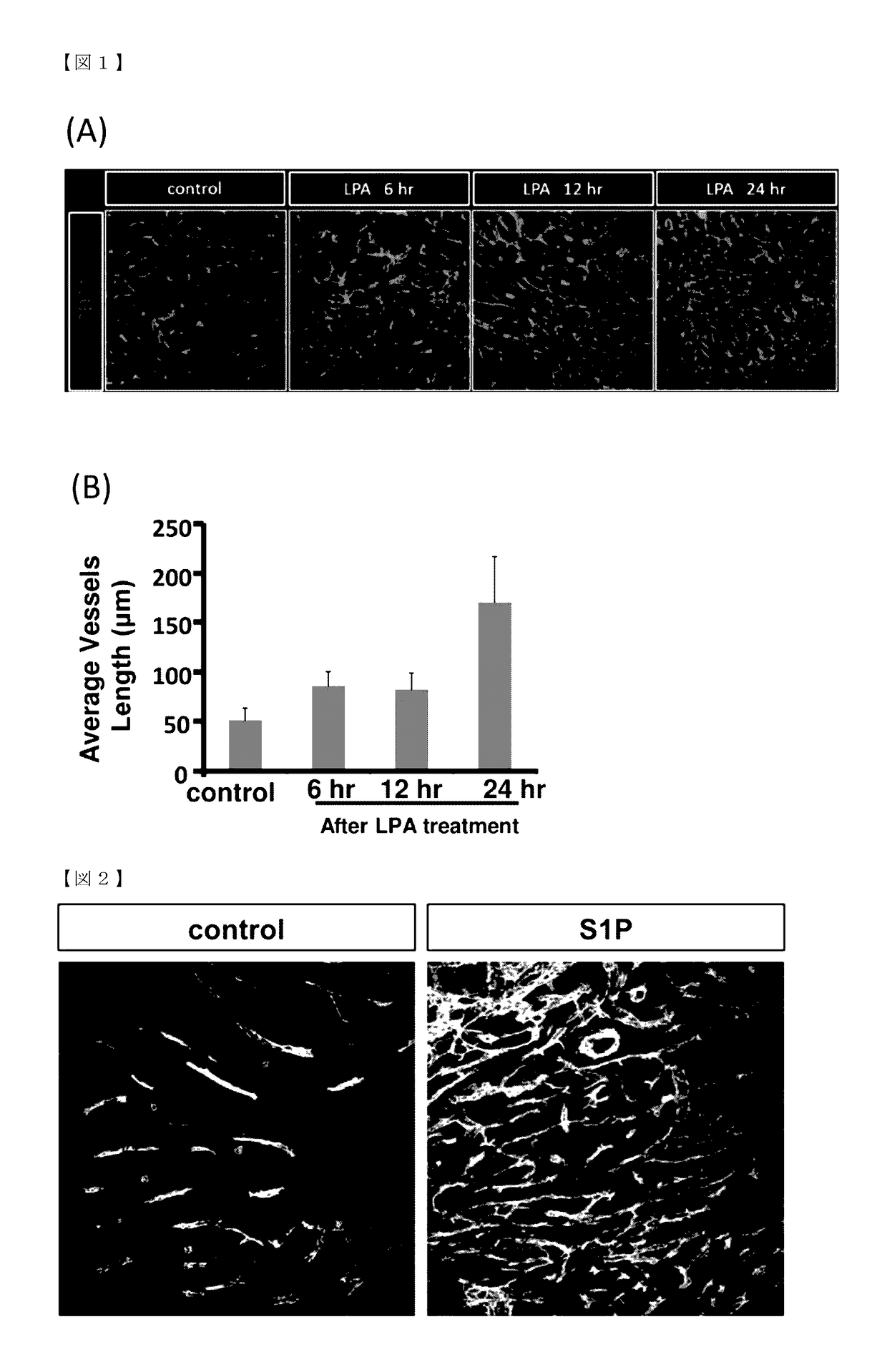 Drug delivery enhancer comprising substance for activating lysophospholipid receptors