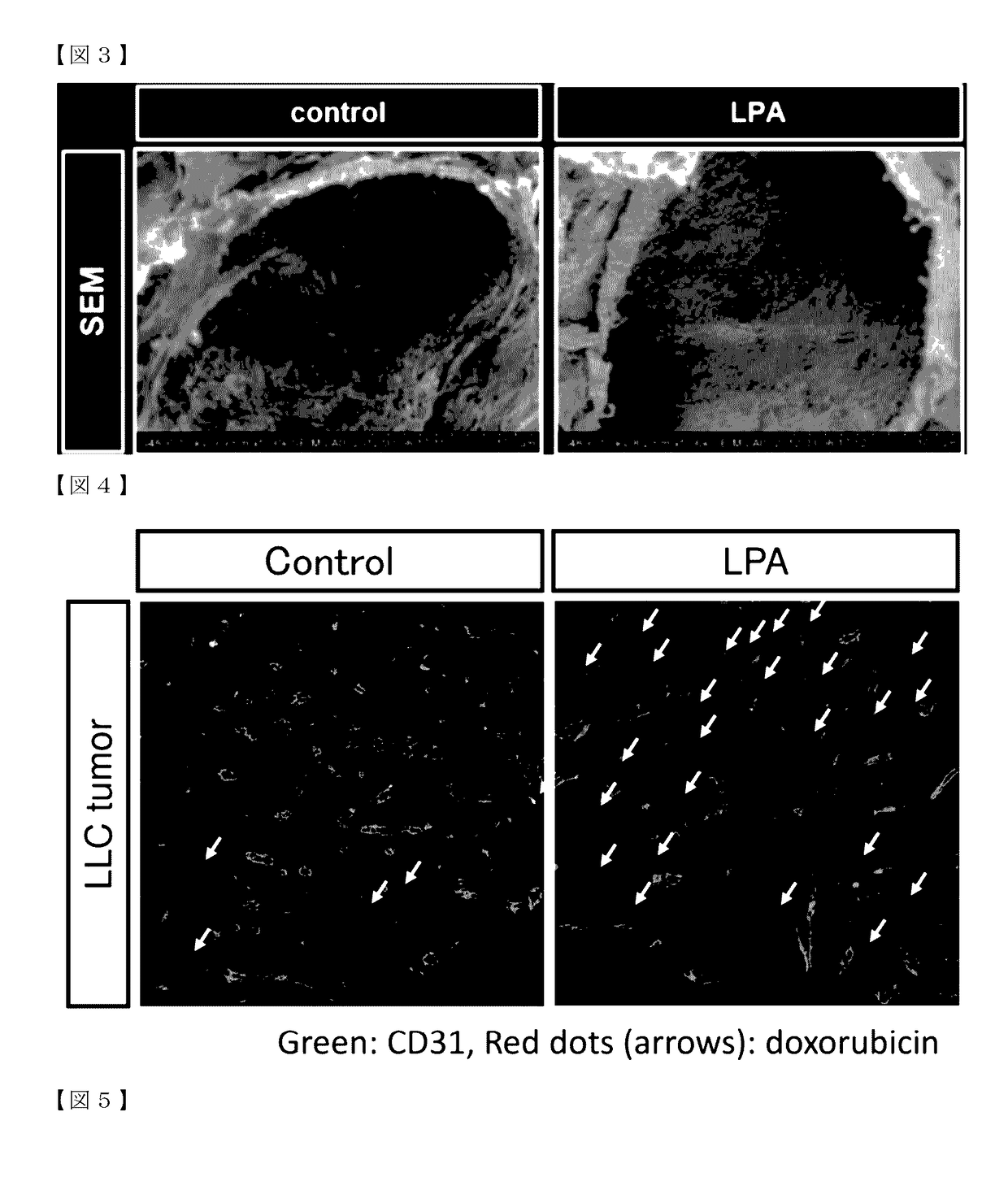 Drug delivery enhancer comprising substance for activating lysophospholipid receptors