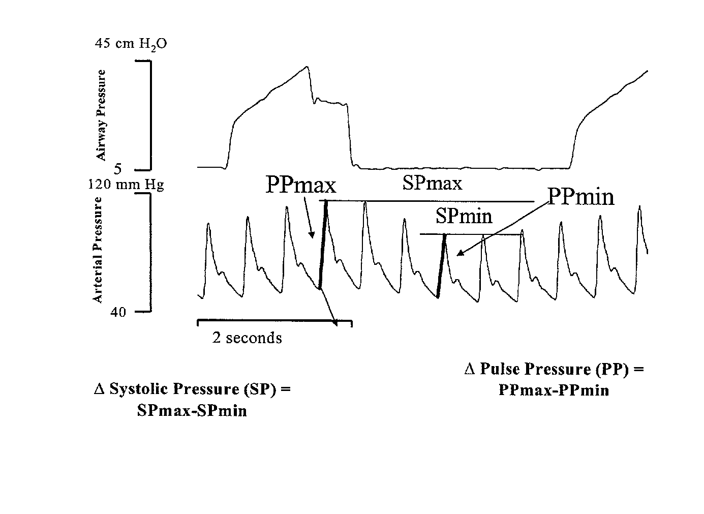 Use of aortic pulse pressure and flow in bedside hemodynamic management