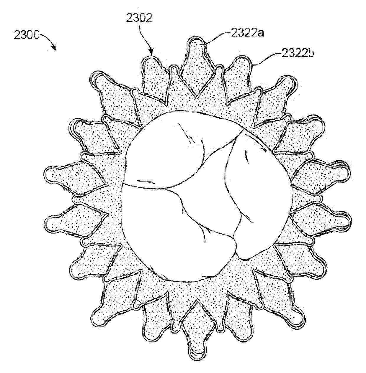 Replacement mitral valves