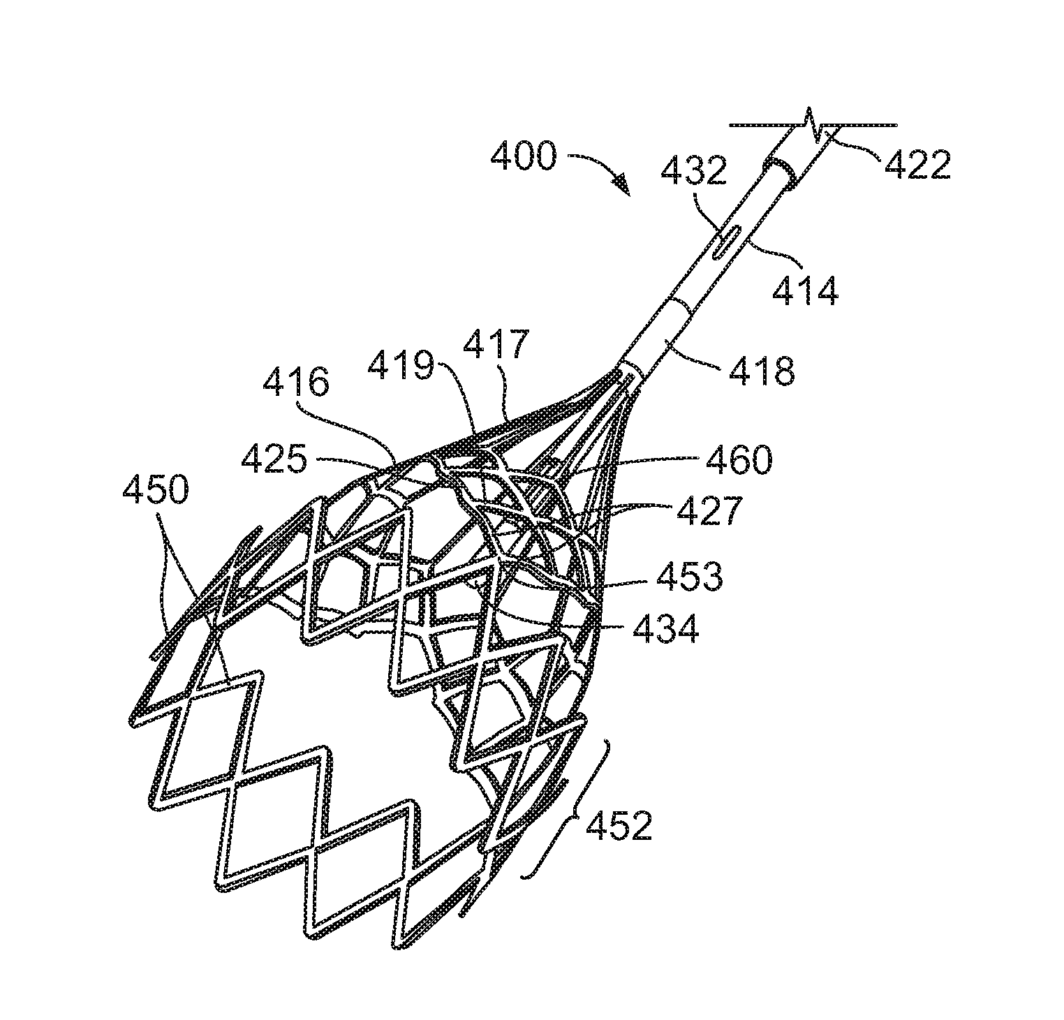 Ivc filter catheter with imaging modality