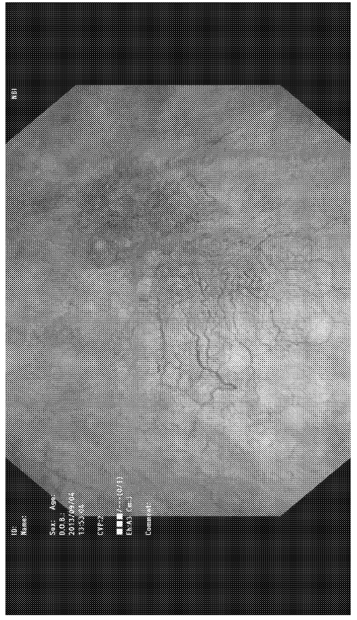 Therapeutic agent for lower urinary tract disease