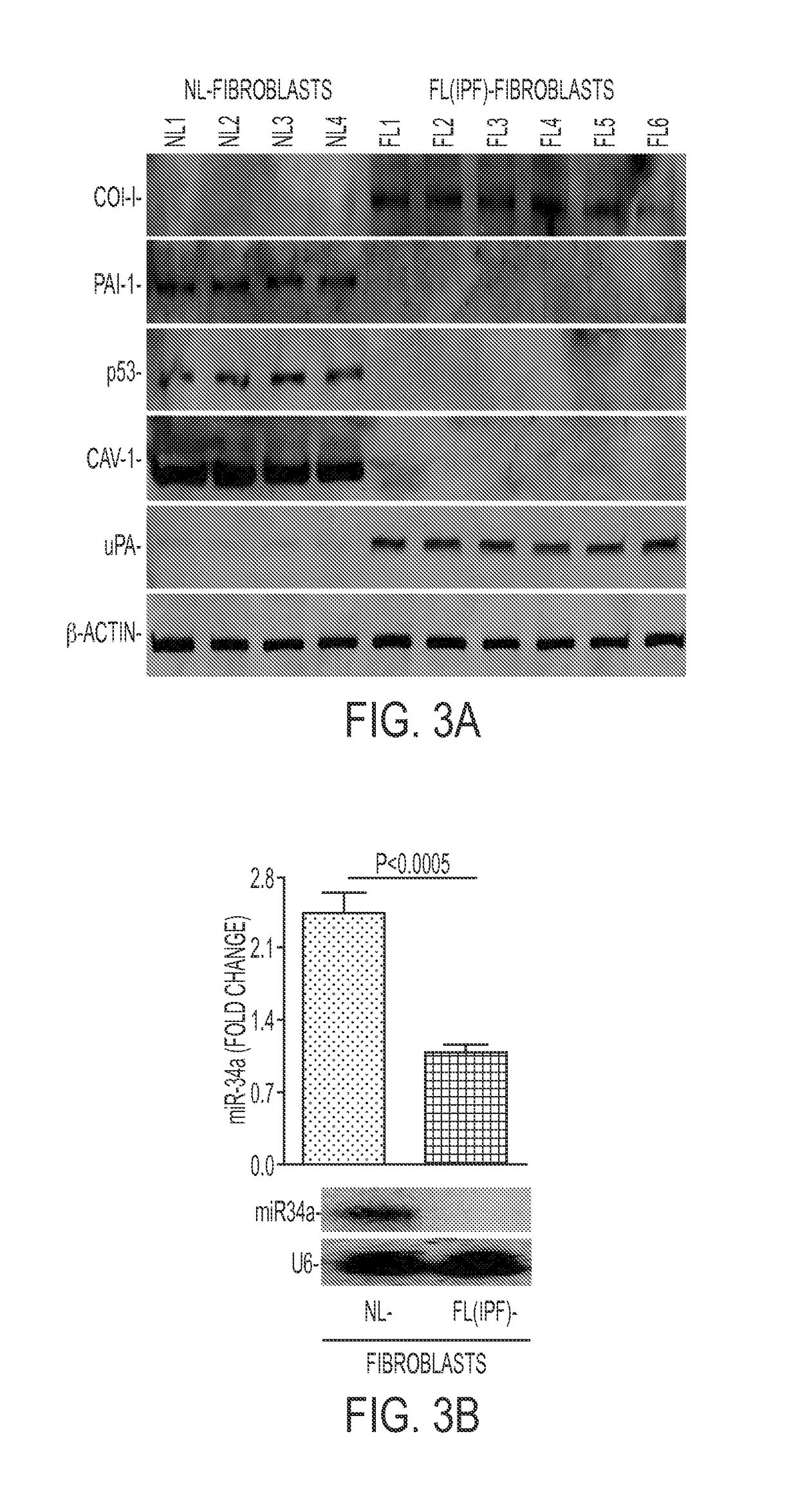 Inhibition of pulmonary fibrosis with nutlin-3A and peptides