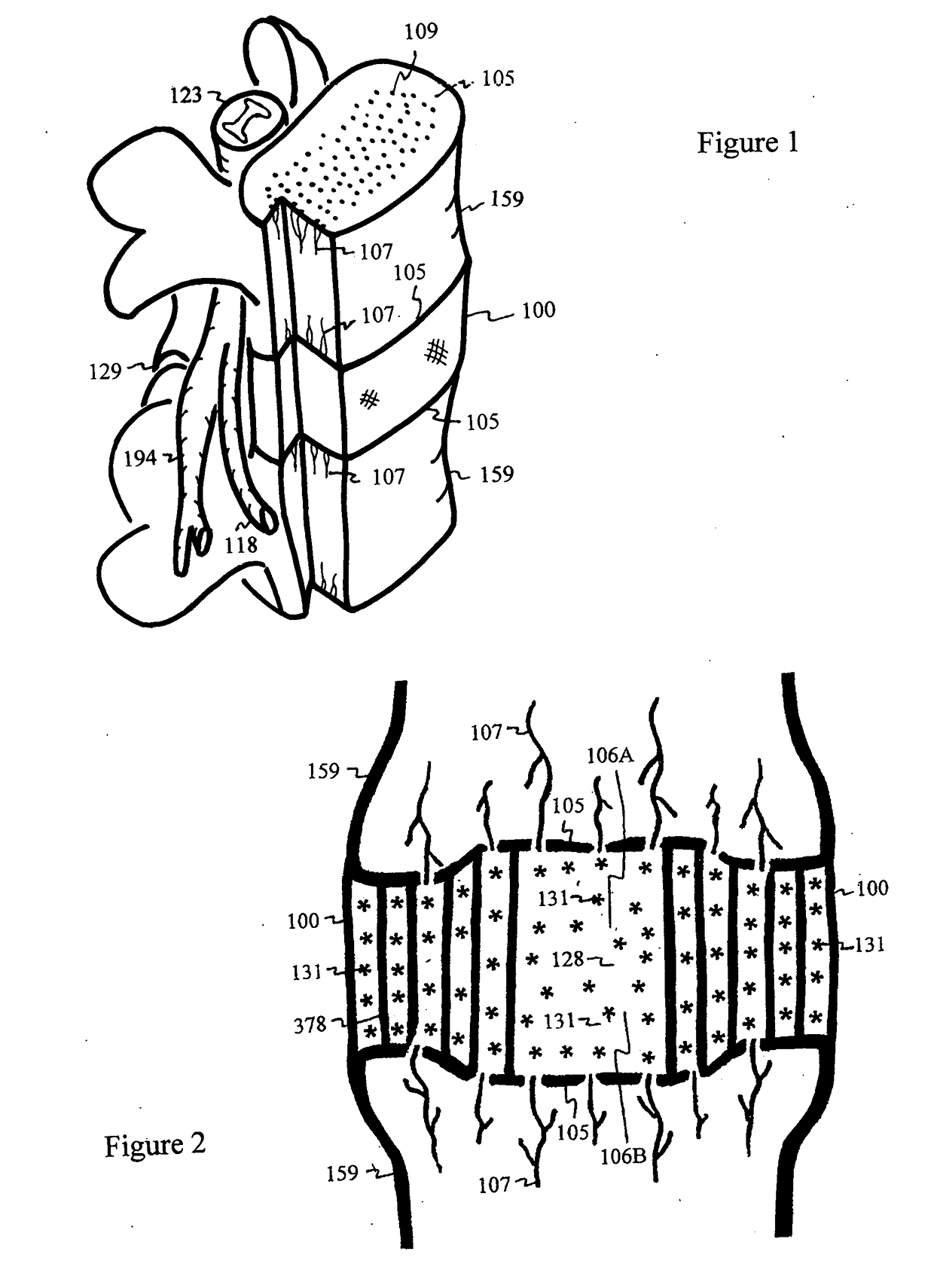 Method for relieving pain and regenerating intervertebral disc