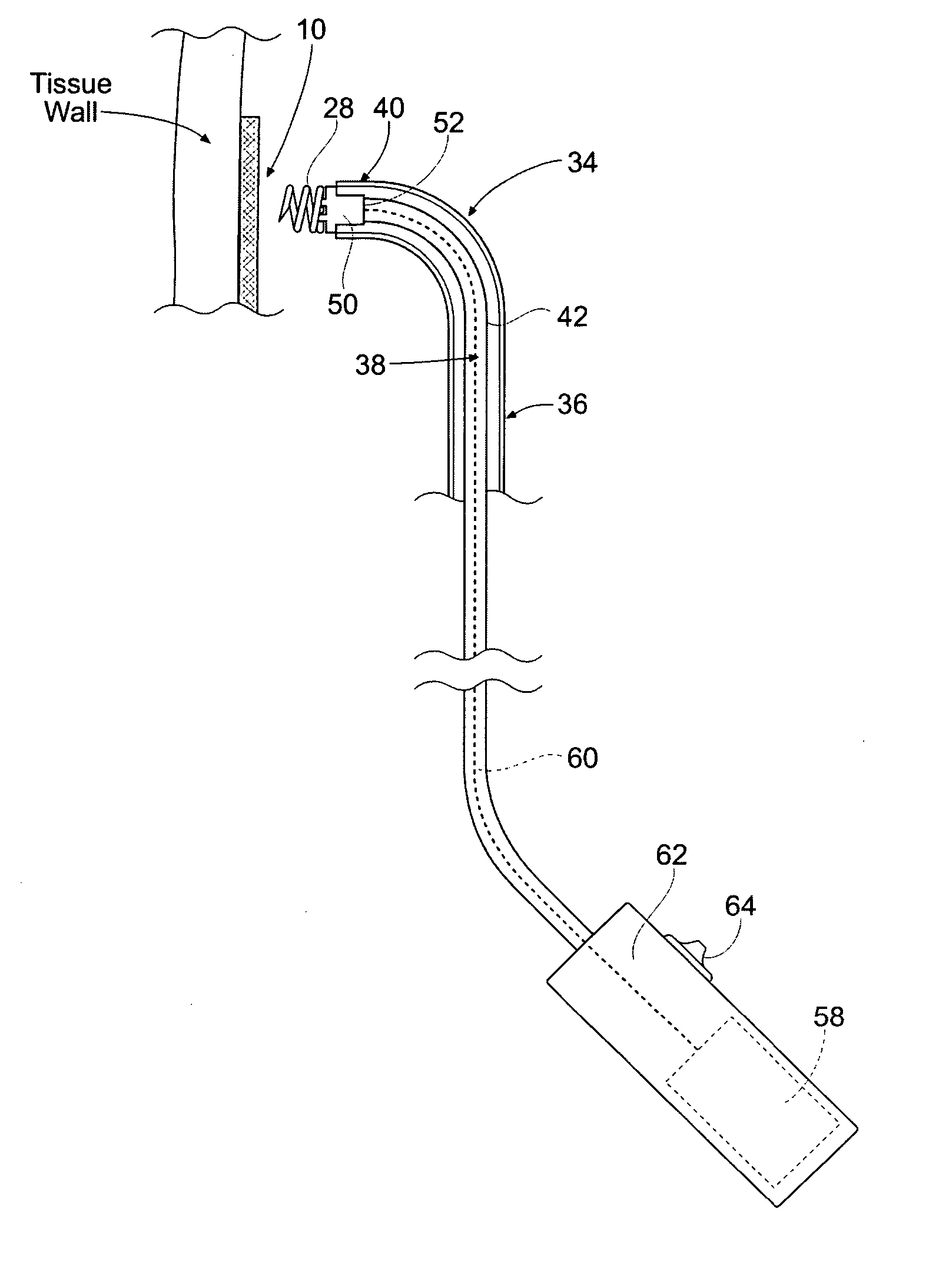 Systems and methods for attaching a prosthesis within a body lumen or hollow organ