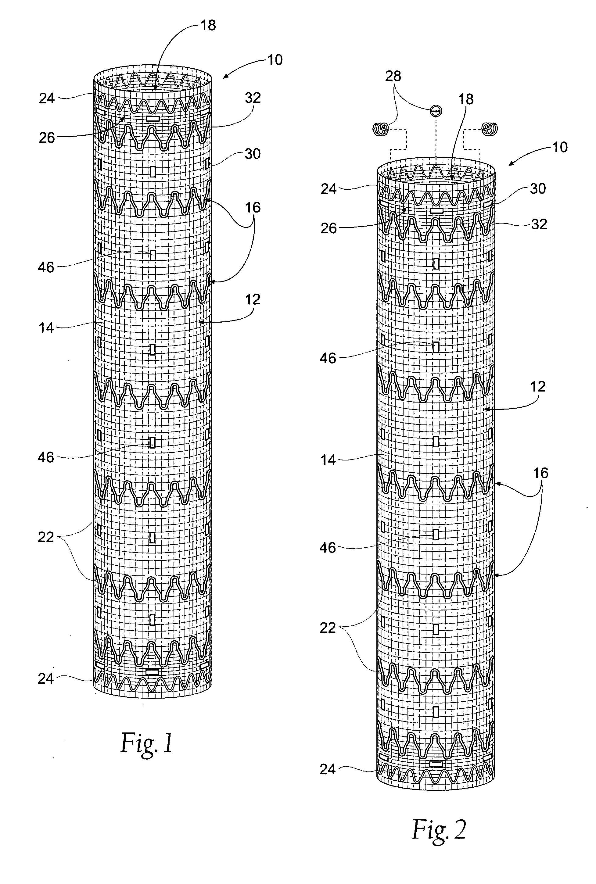 Systems and methods for attaching a prosthesis within a body lumen or hollow organ