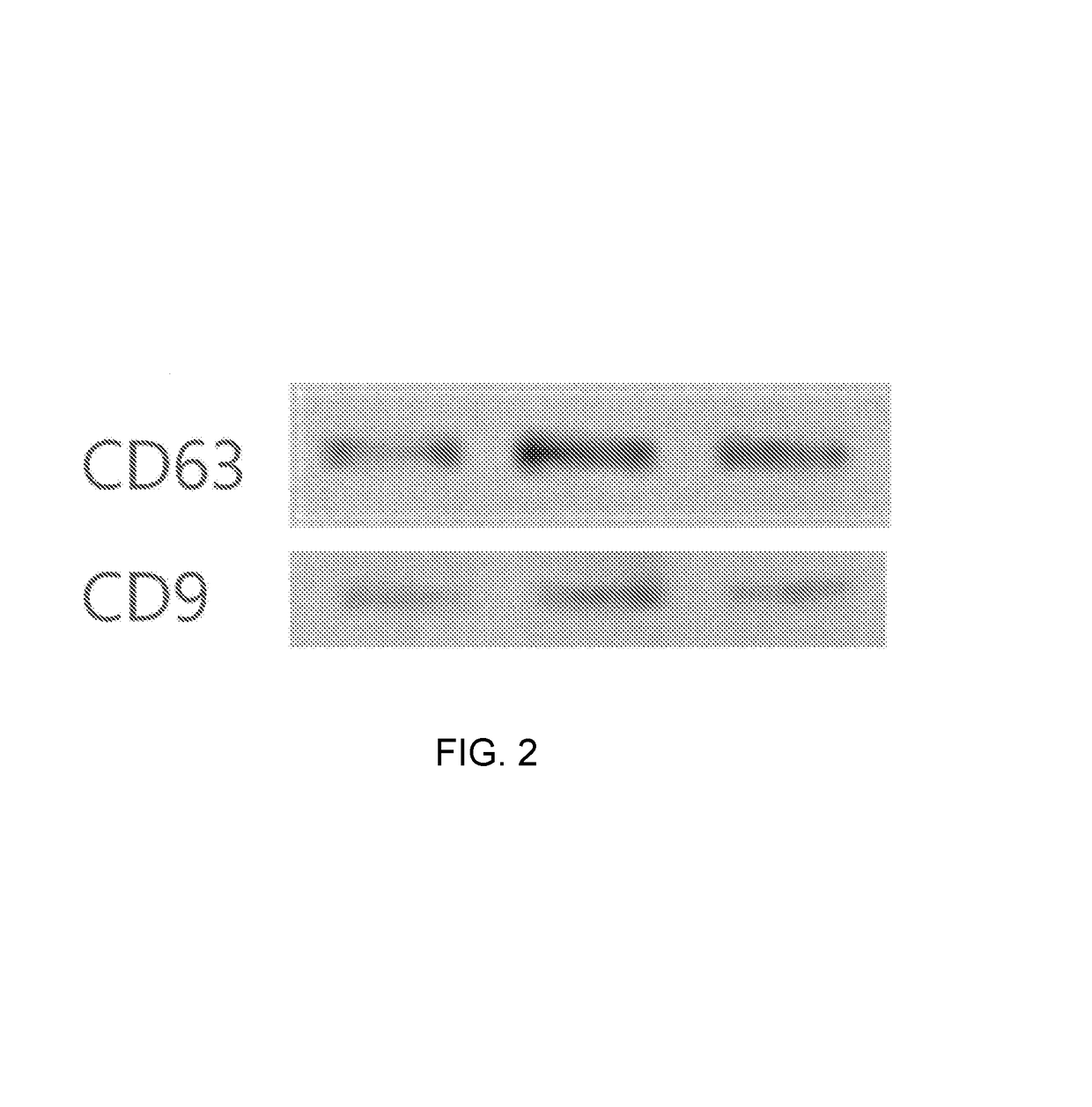 Pharmaceutical composition for treating cerebrovascular diseases, containing stem cell-derived exosome as active ingredient