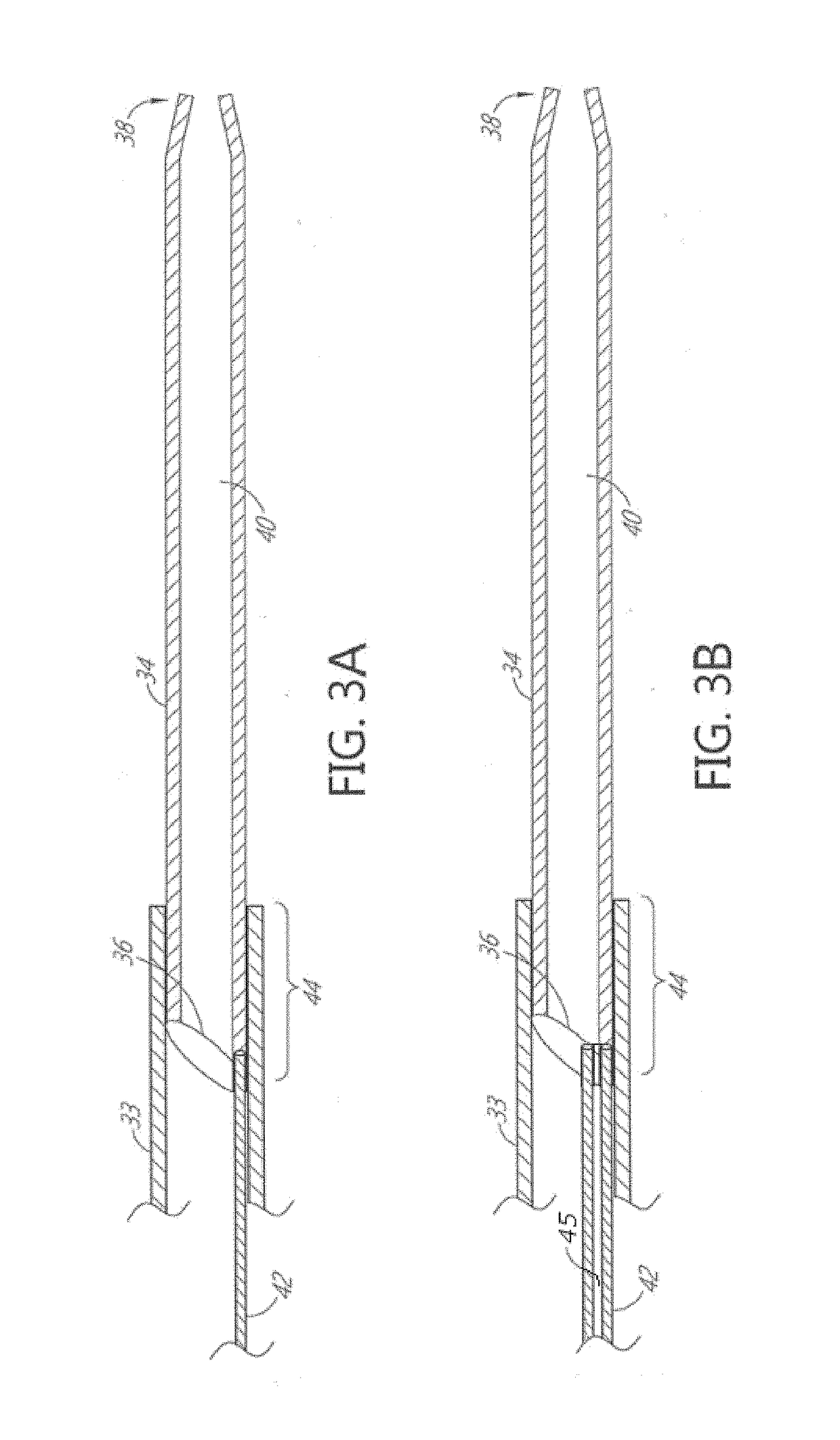 Enhanced flexibility neurovascular catheter with tensile support