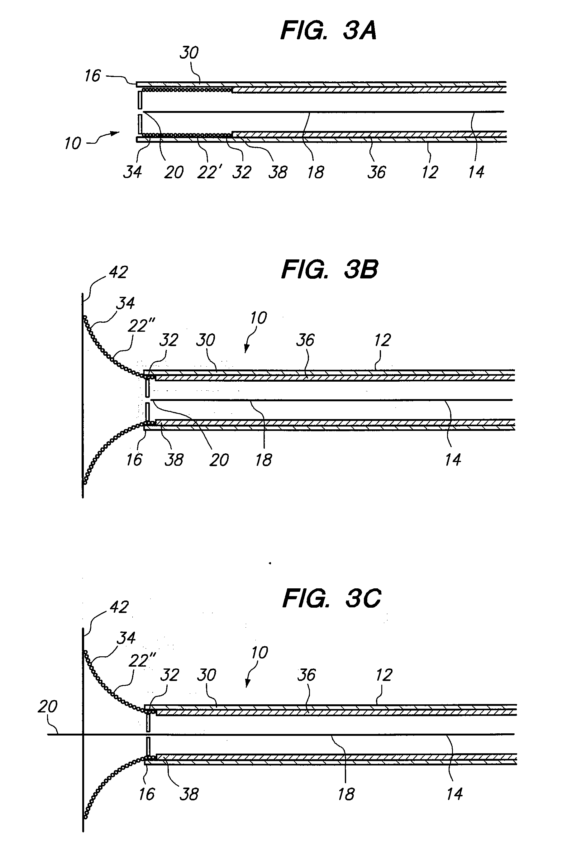 Myocardial injector