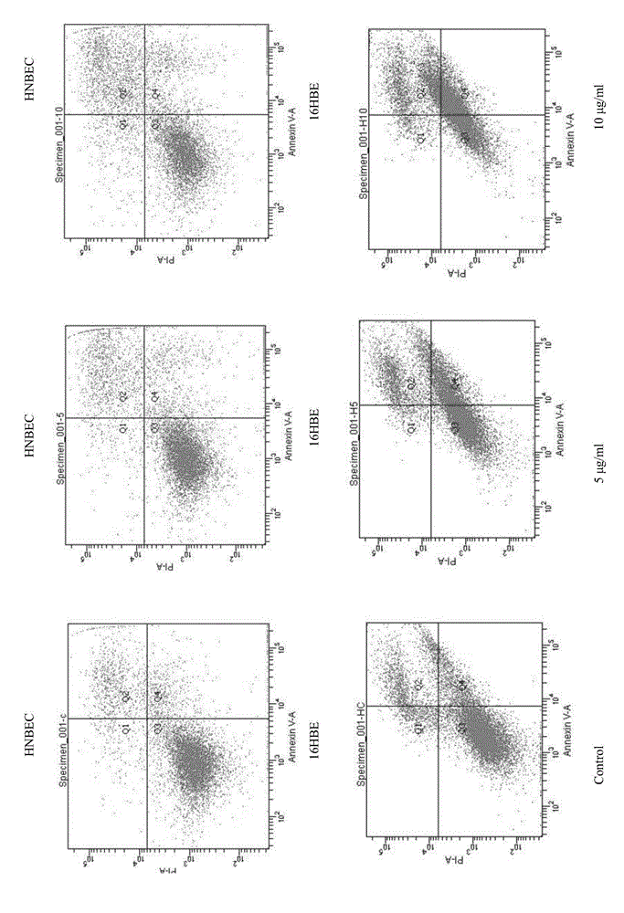 Culture medium for normal epithelial cell of human or mammal, culture methods, normal epithelial cell and application of normal epithelial cell