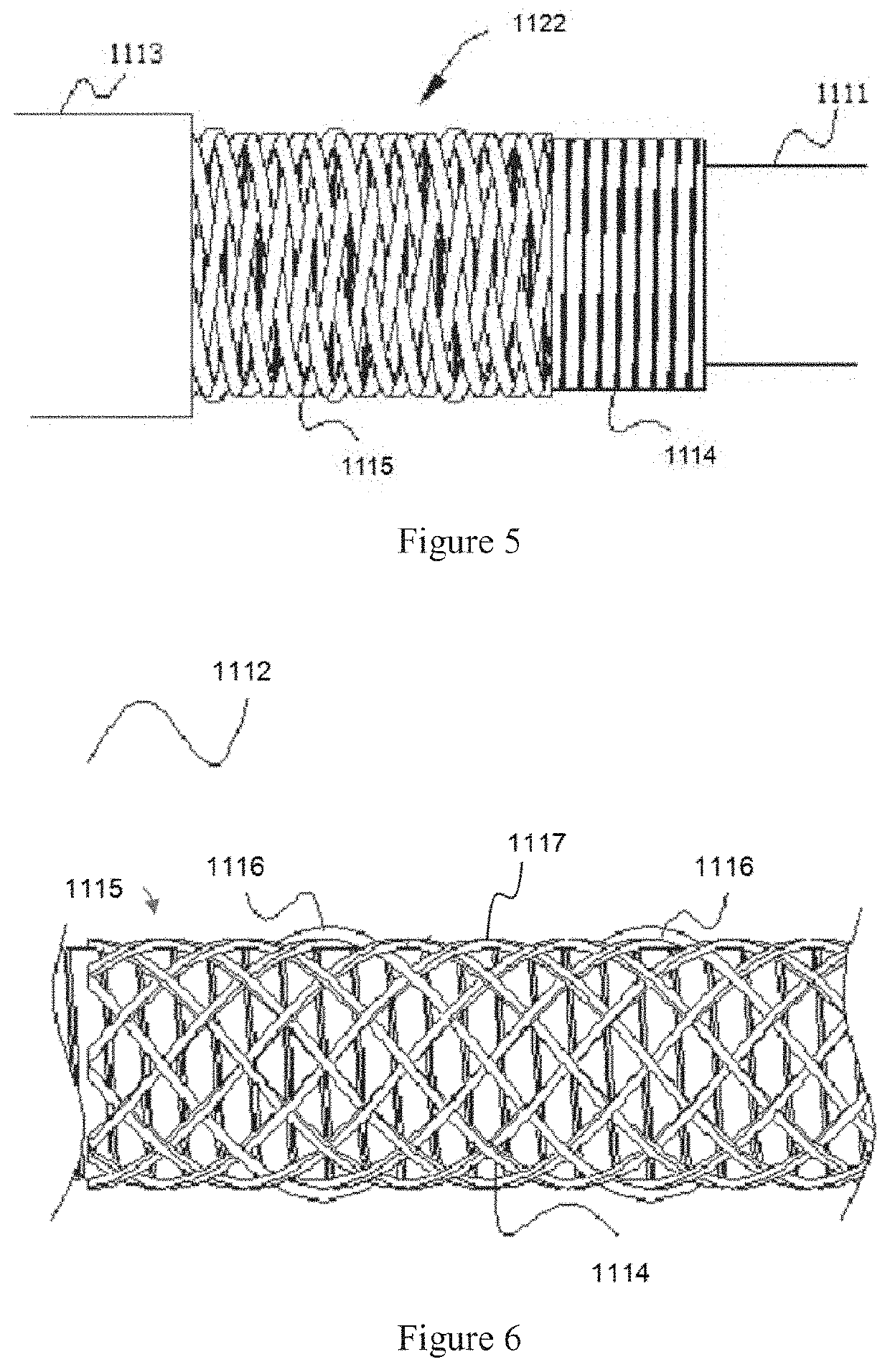 Microcatheter