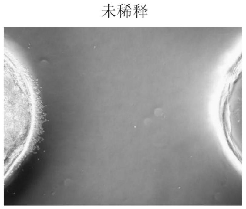 Application of Nocardia rubra cell wall skeleton as neutrophil modulator