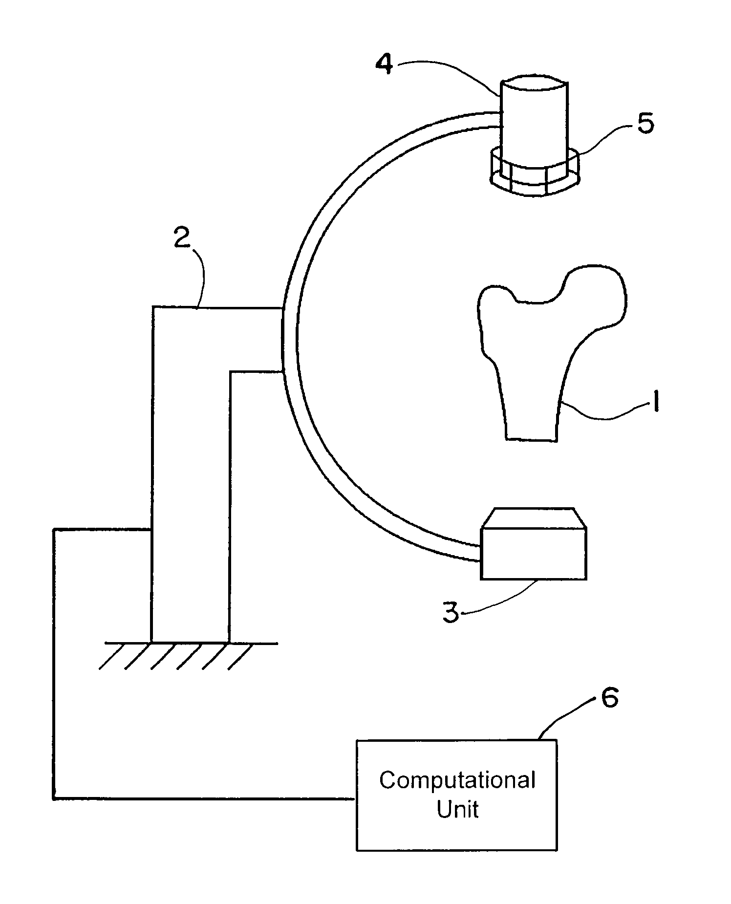 Shape reconstruction using X-ray images