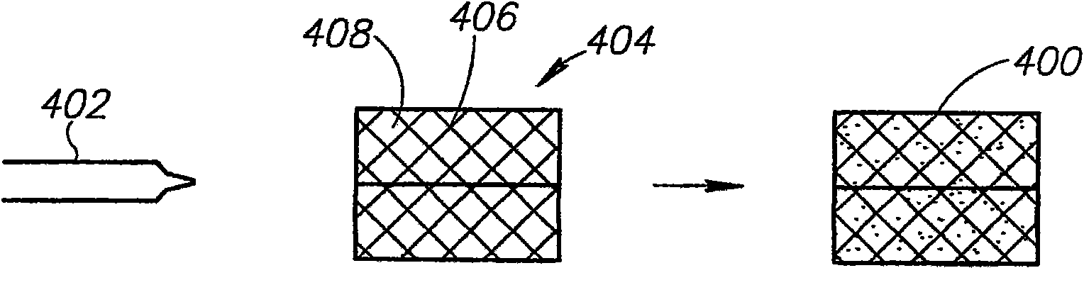 Colloidal collagen burn wound dressing produced from jellyfish