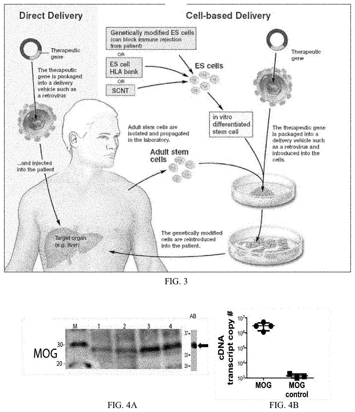 Aav-based gene therapies for treatment of autoimmune diseases