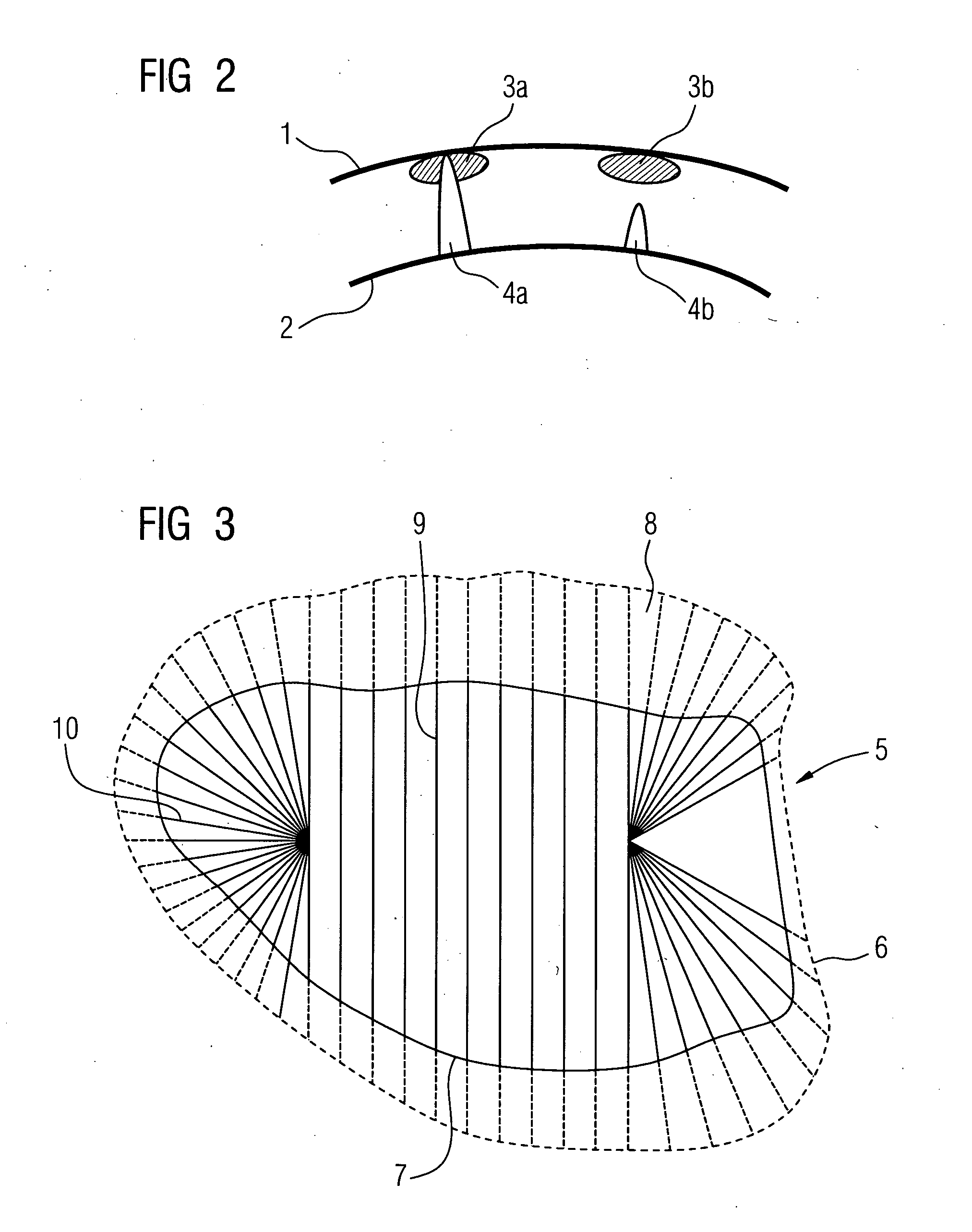 Method for determining an optimal output of an ablation catheter for a myocardial ablation in a patient and associated medical apparatus