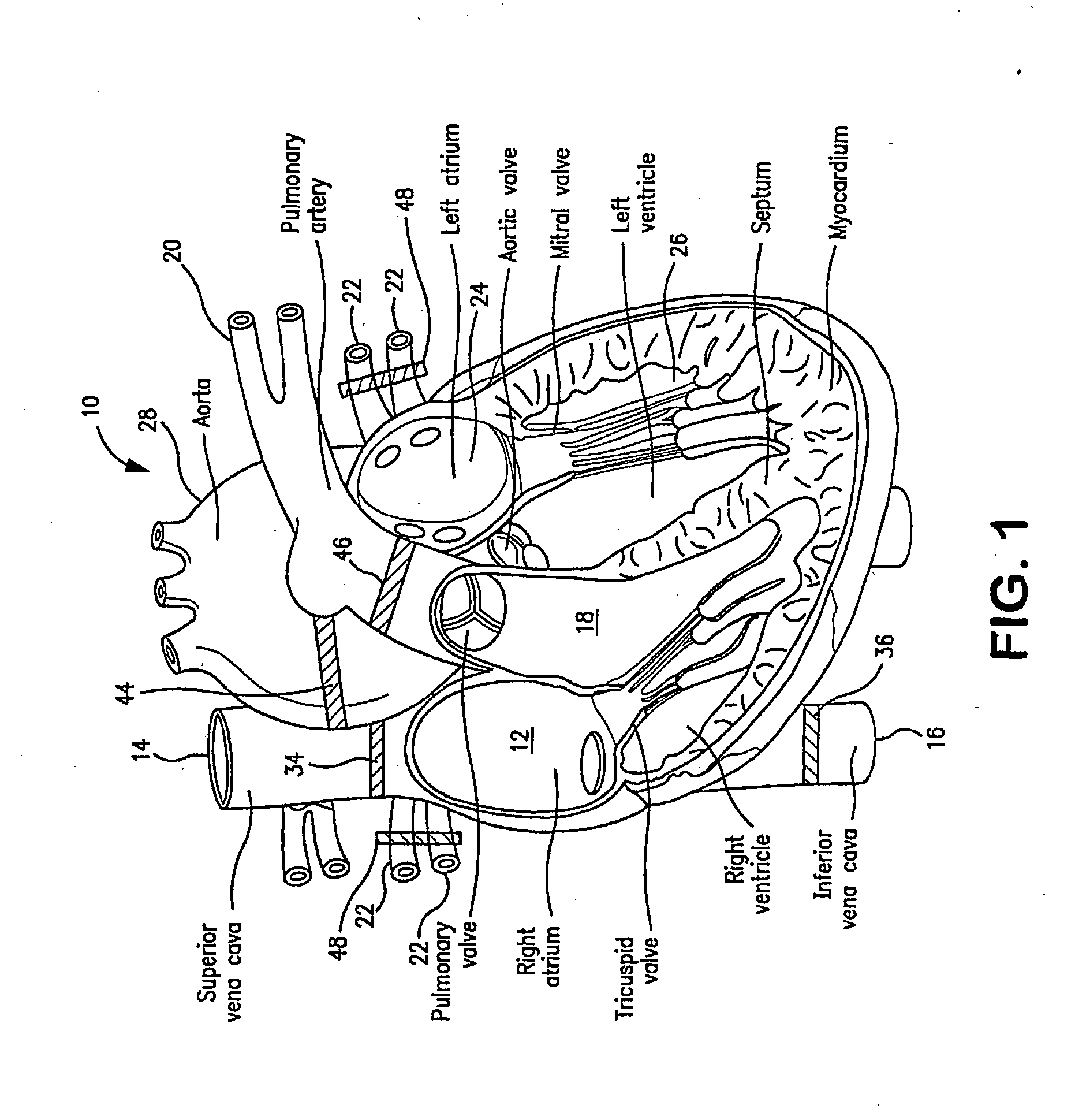 Perfusion circuit and use therein in targeted delivery of macromolecules