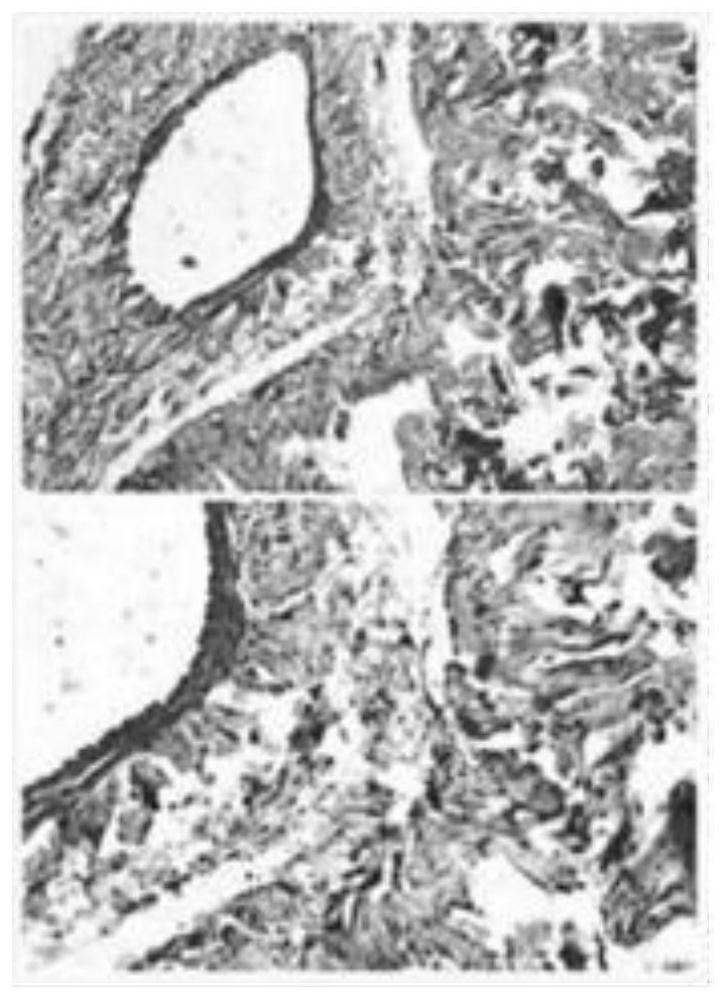 Traditional Chinese medicine composition and application thereof in preparation of erectile dysfunction treatment medicines