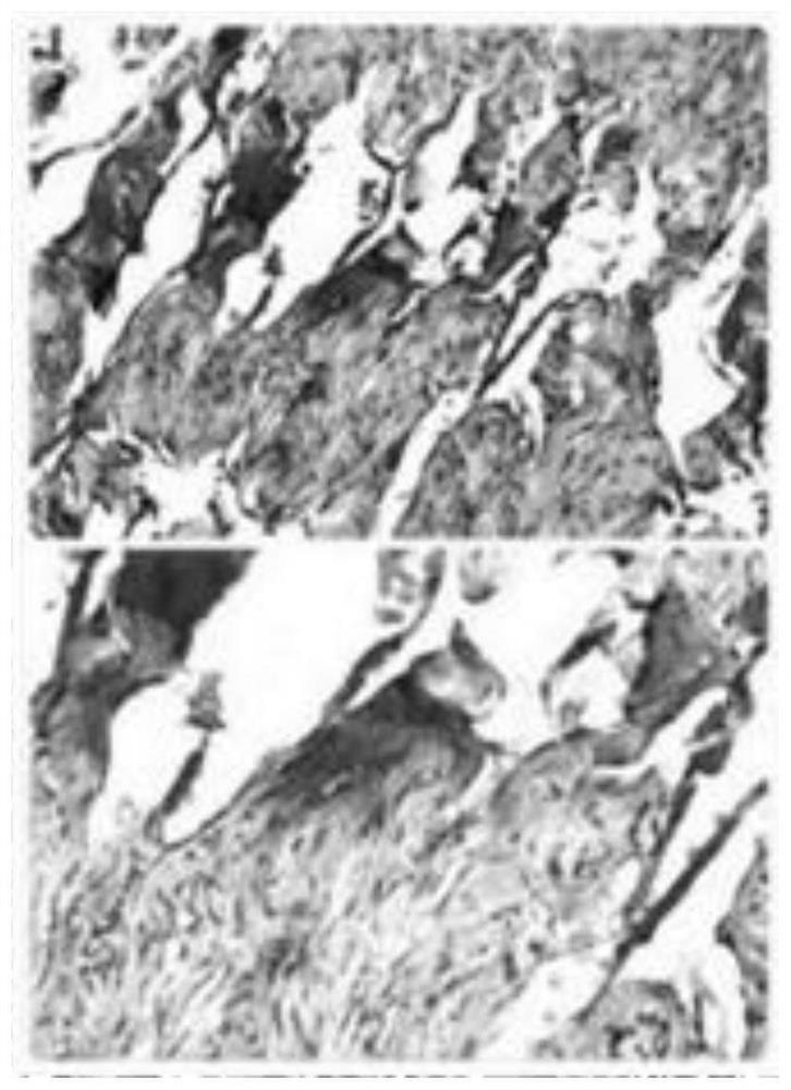 Traditional Chinese medicine composition and application thereof in preparation of erectile dysfunction treatment medicines