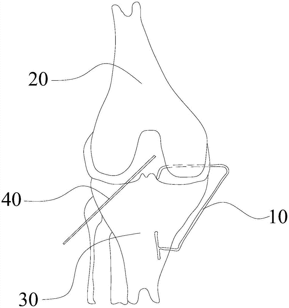 Positioning device