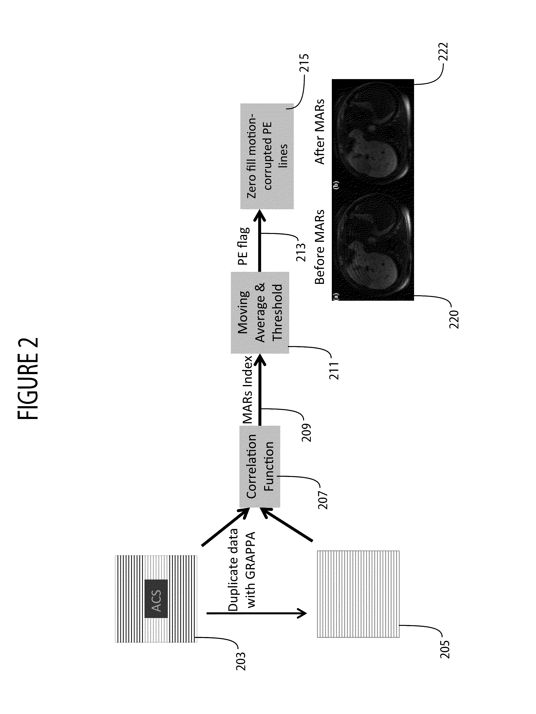 Motion compensated MR imaging system