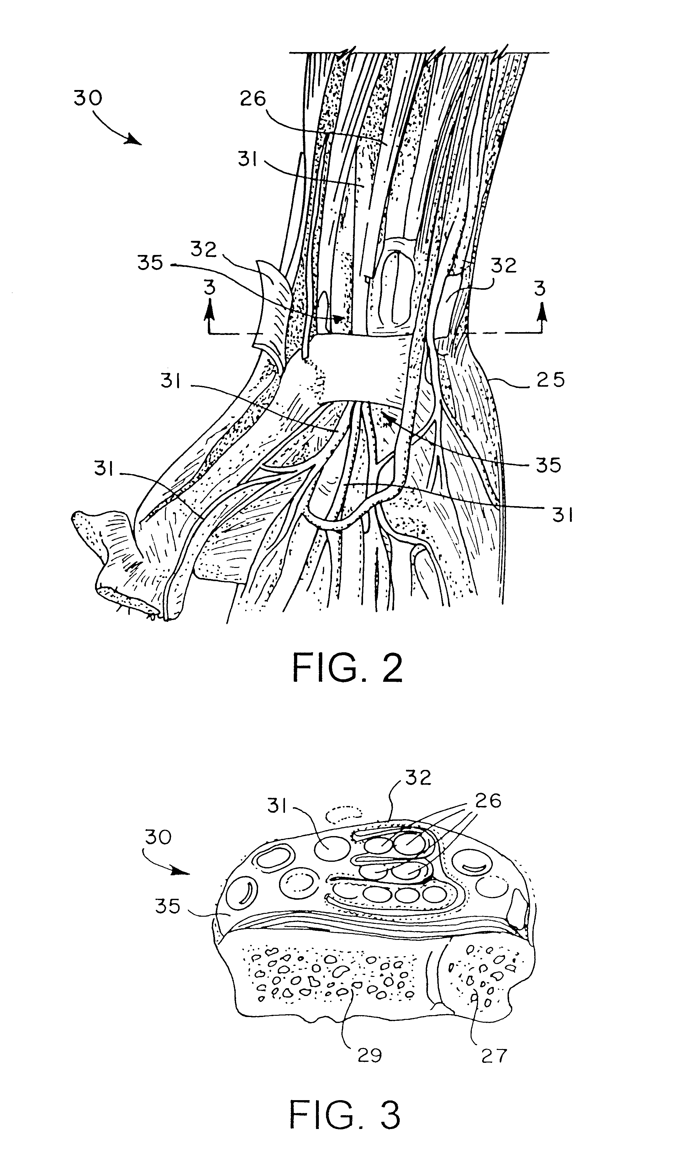 No-impact keyboard