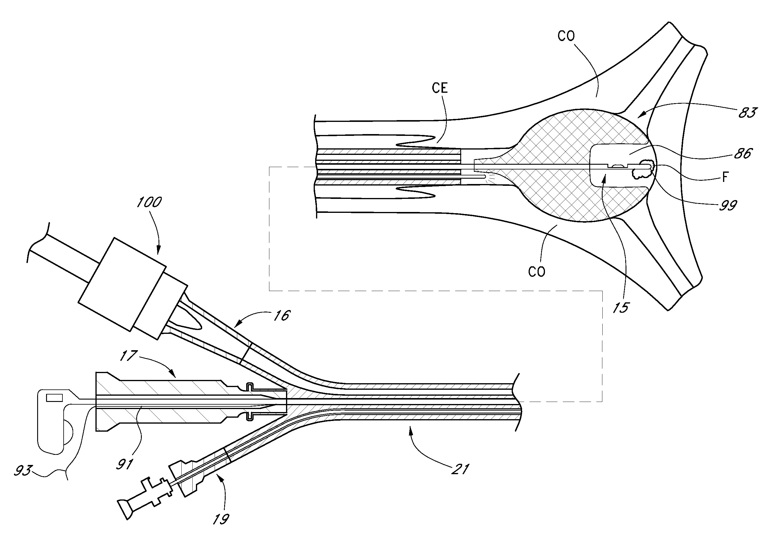 Methods for performing a medical procedure