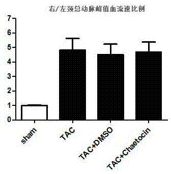 Application of Chaetin in Preparation of Drugs for Preventing and Treating Heart Disease