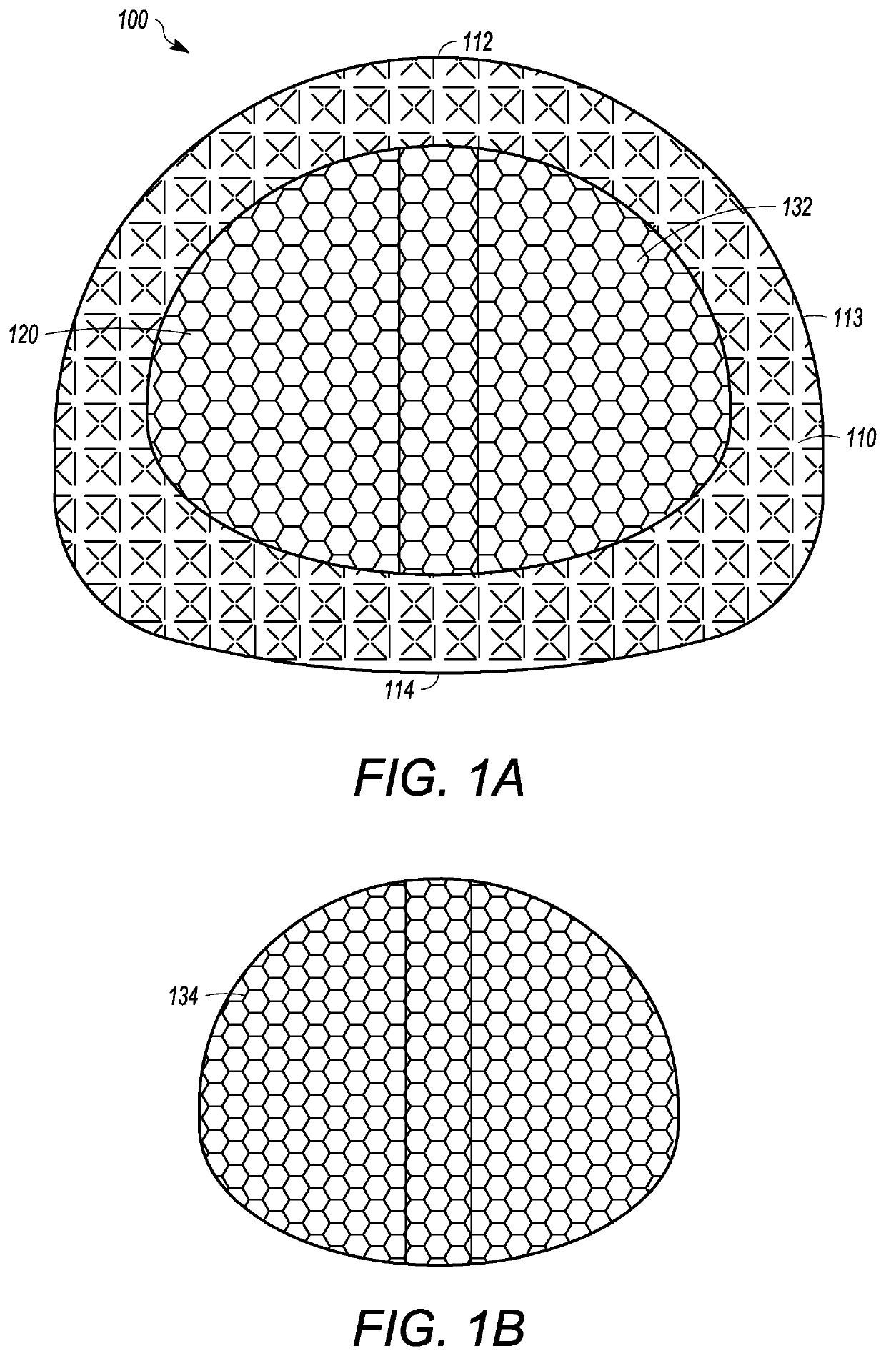 Interbody cage with spill-free biological material compartment