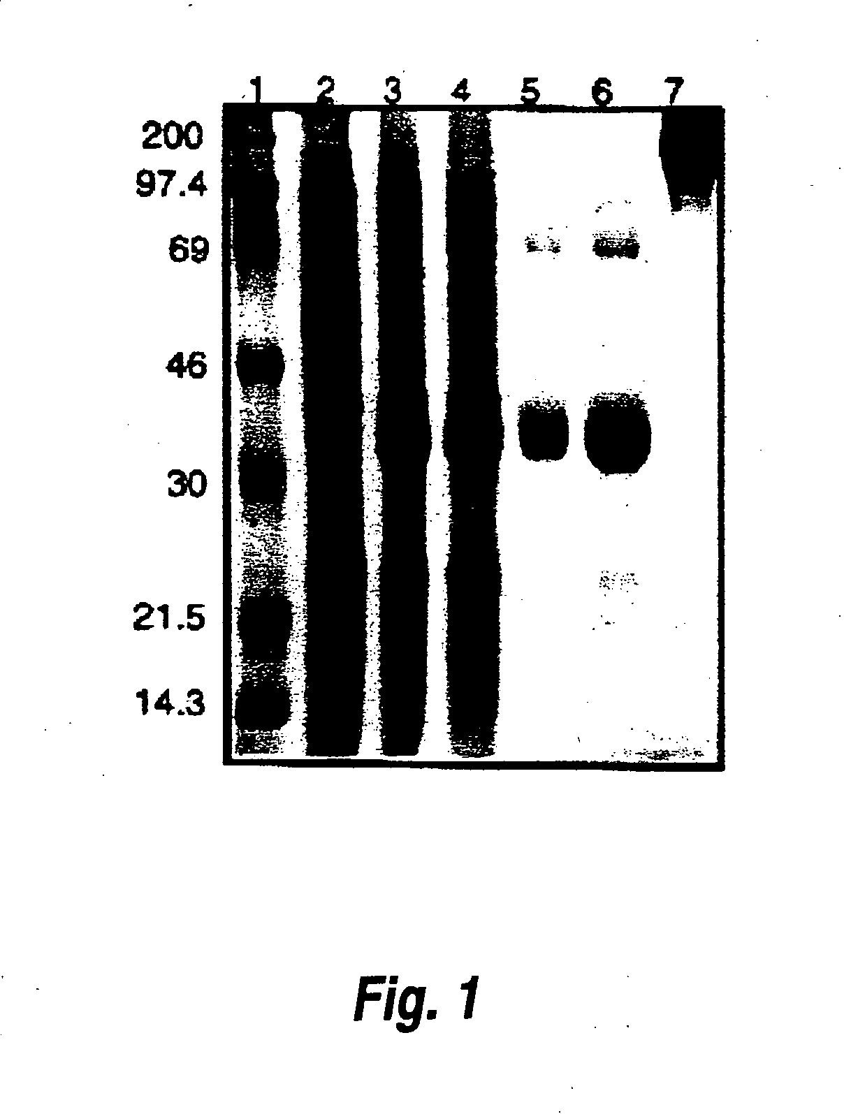 Urate oxidase