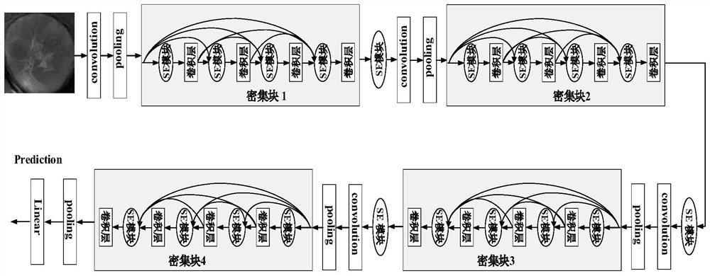 Liver tumor MVI prediction method based on triple network