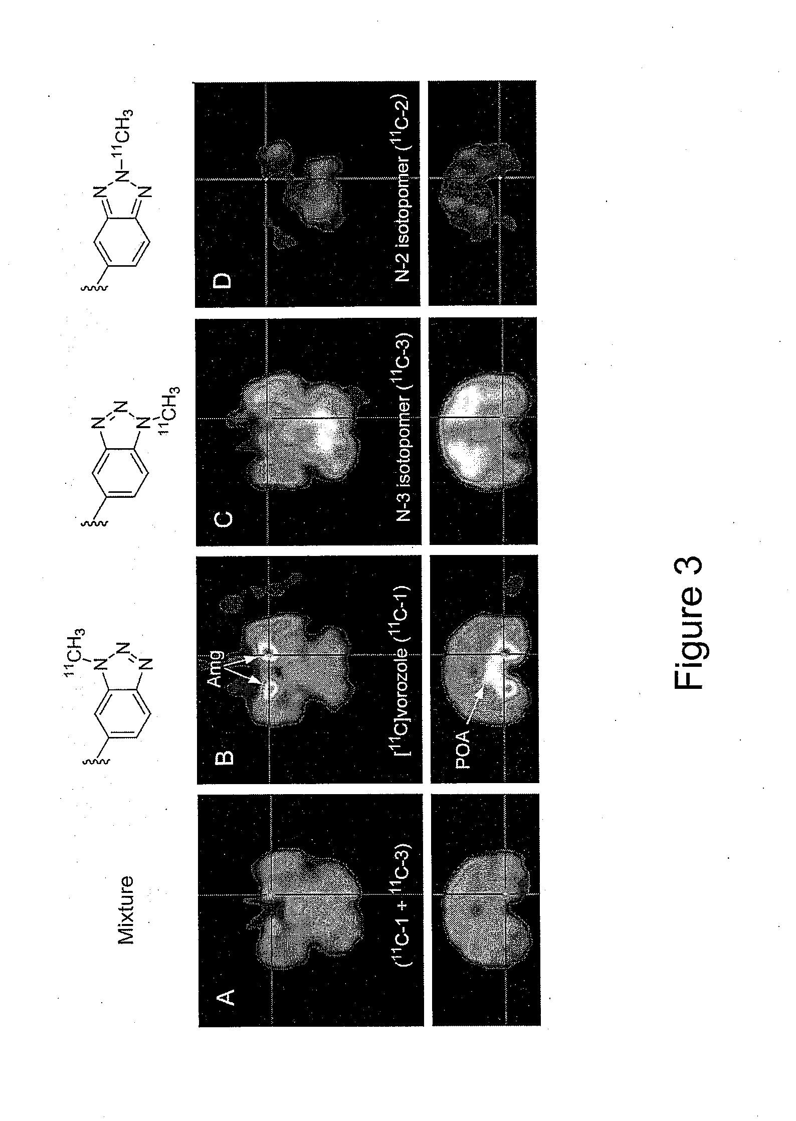 Radio-methyl Vorozole and Methods for Making and Using the Same