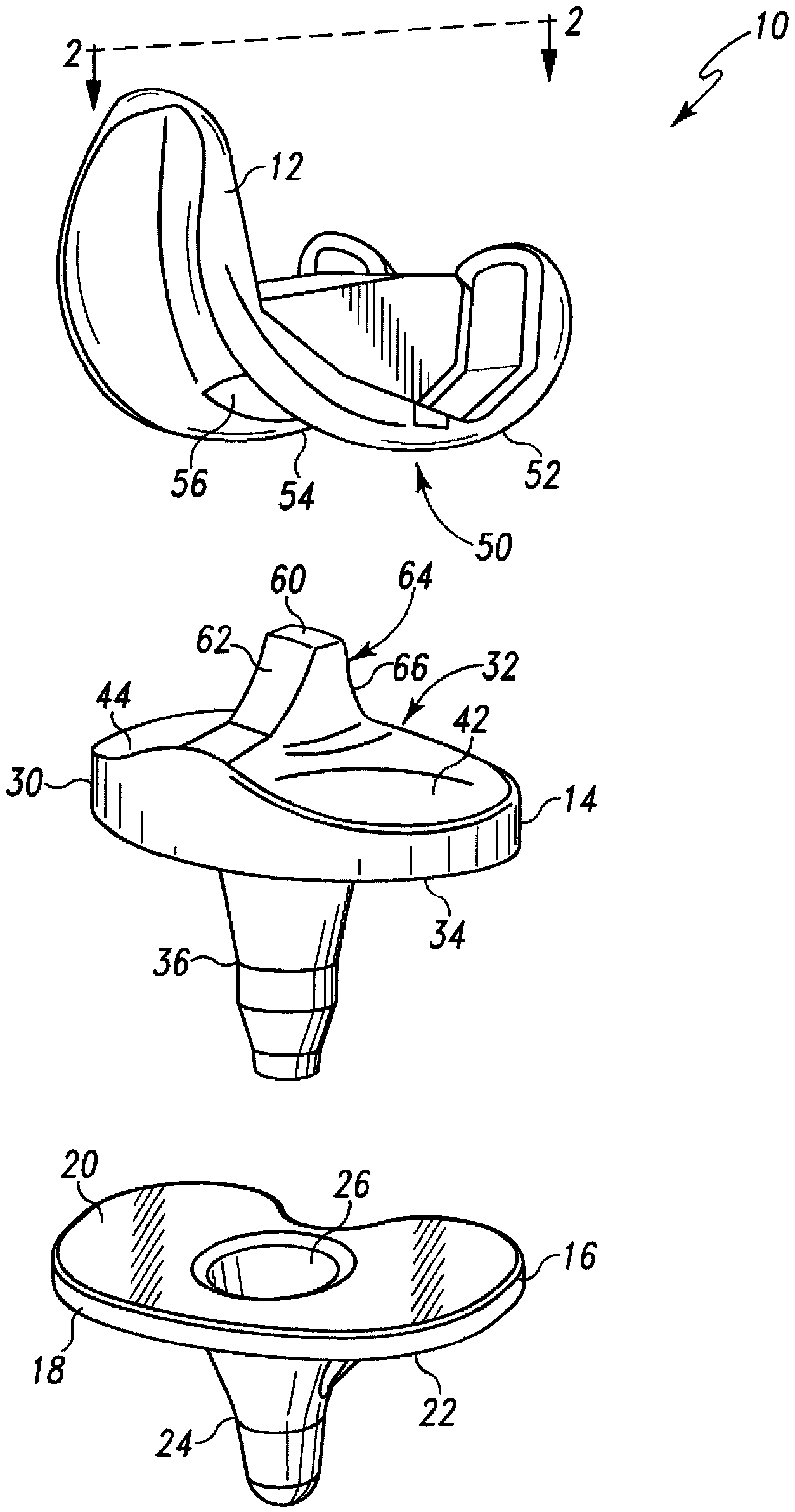 Posterior stabilized orthopaedic knee prosthesis having controlled condylar curvature